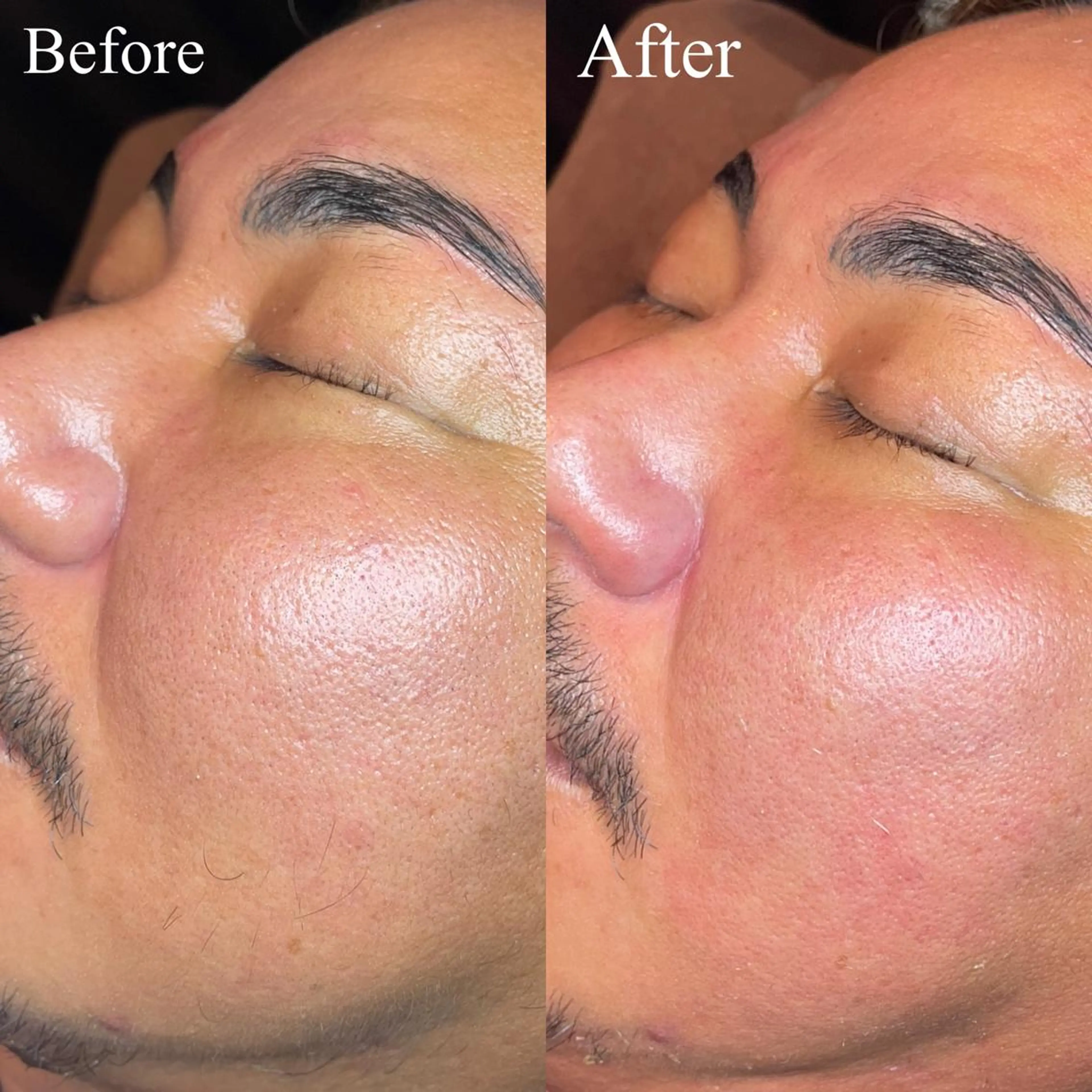 KKSbeauty 🎀心斎橋本店のマツエク・マツパデザイン