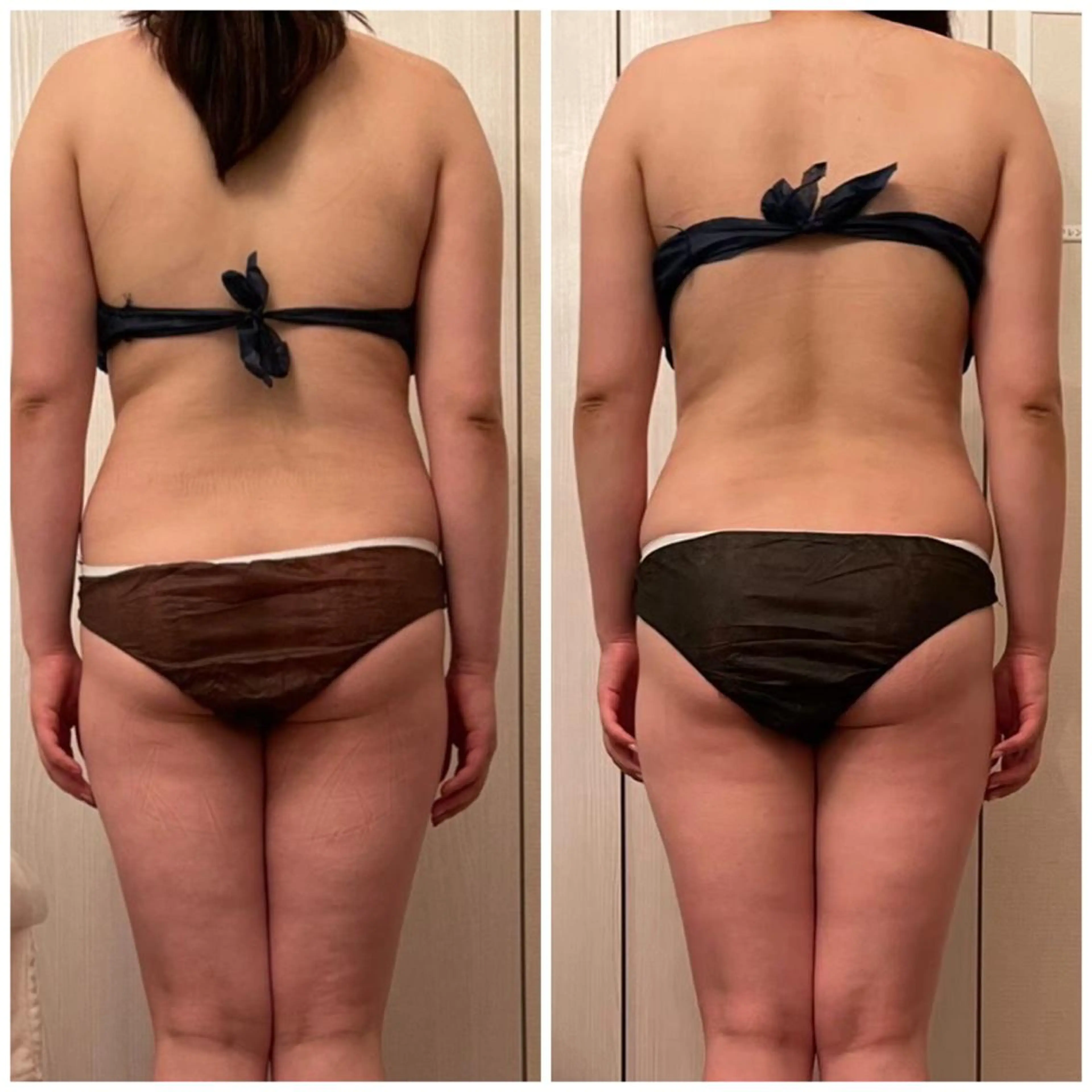 食べながら魅せボディ éclatJua川越のエステ・リラクイメージ