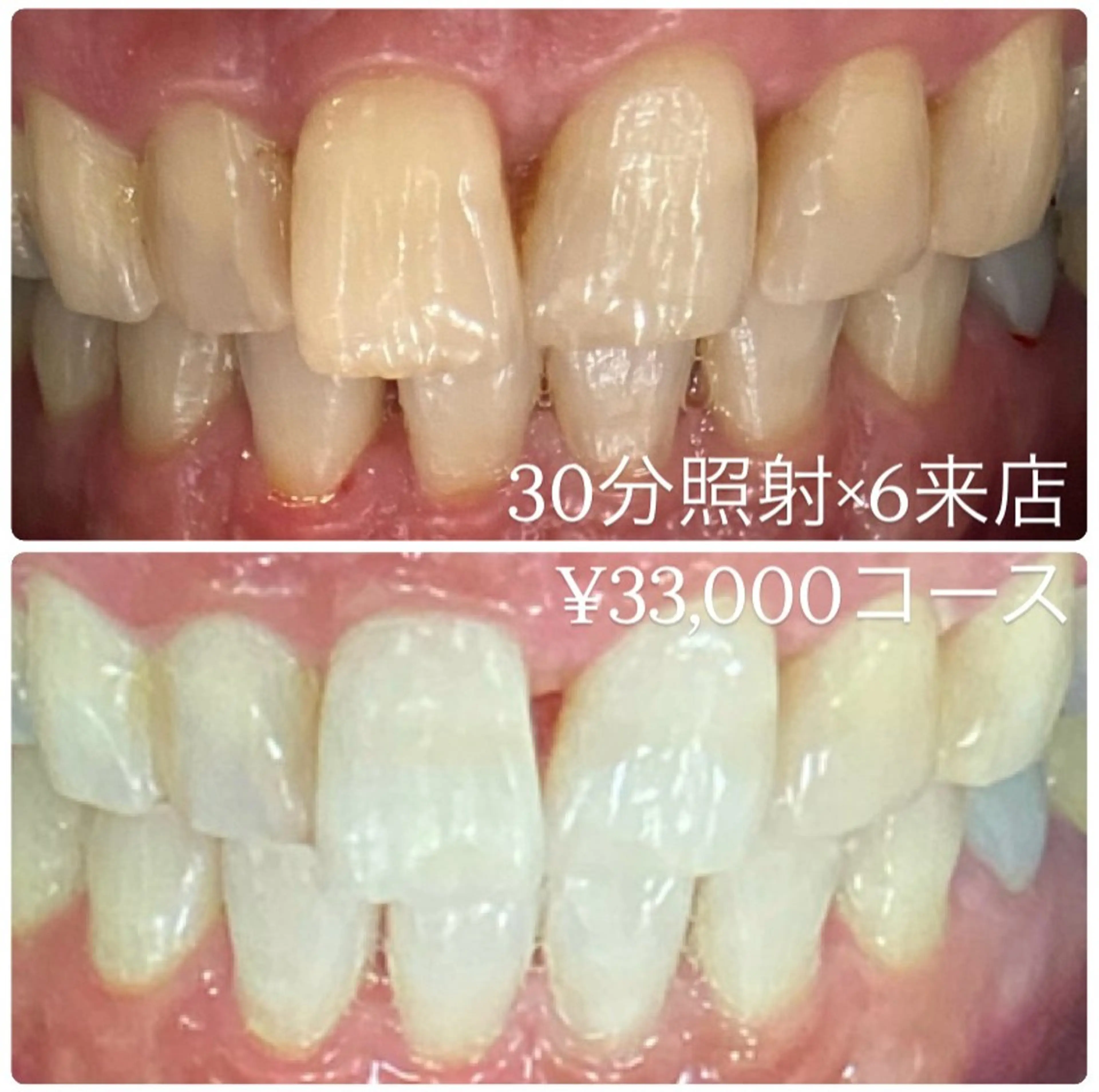 PLATINUM Beauty 横浜店所属・ホワイトニングルーム 横浜店のその他イメージ