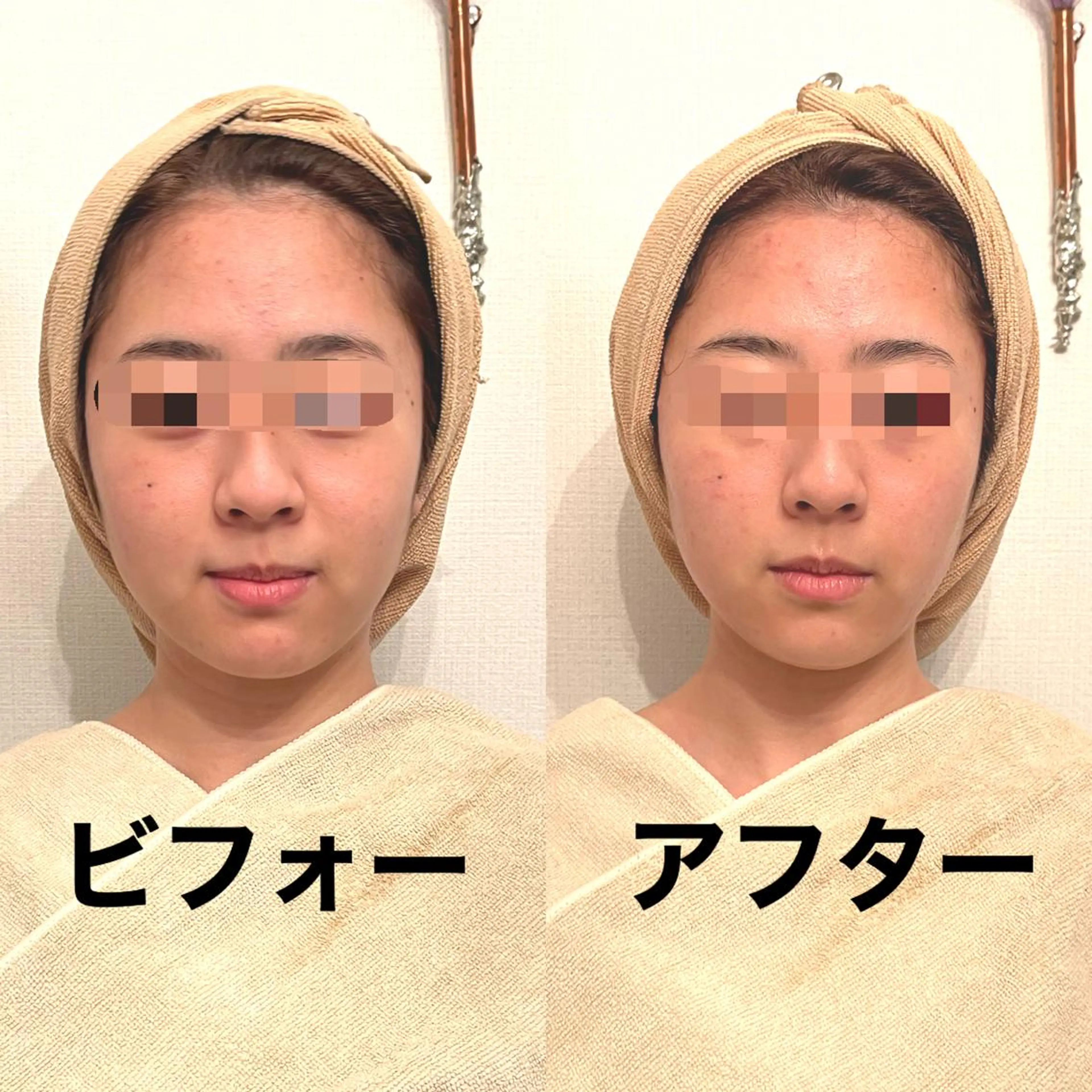 エステ リラク おうちサロン B-ROOMのエステ・リラクイメージ