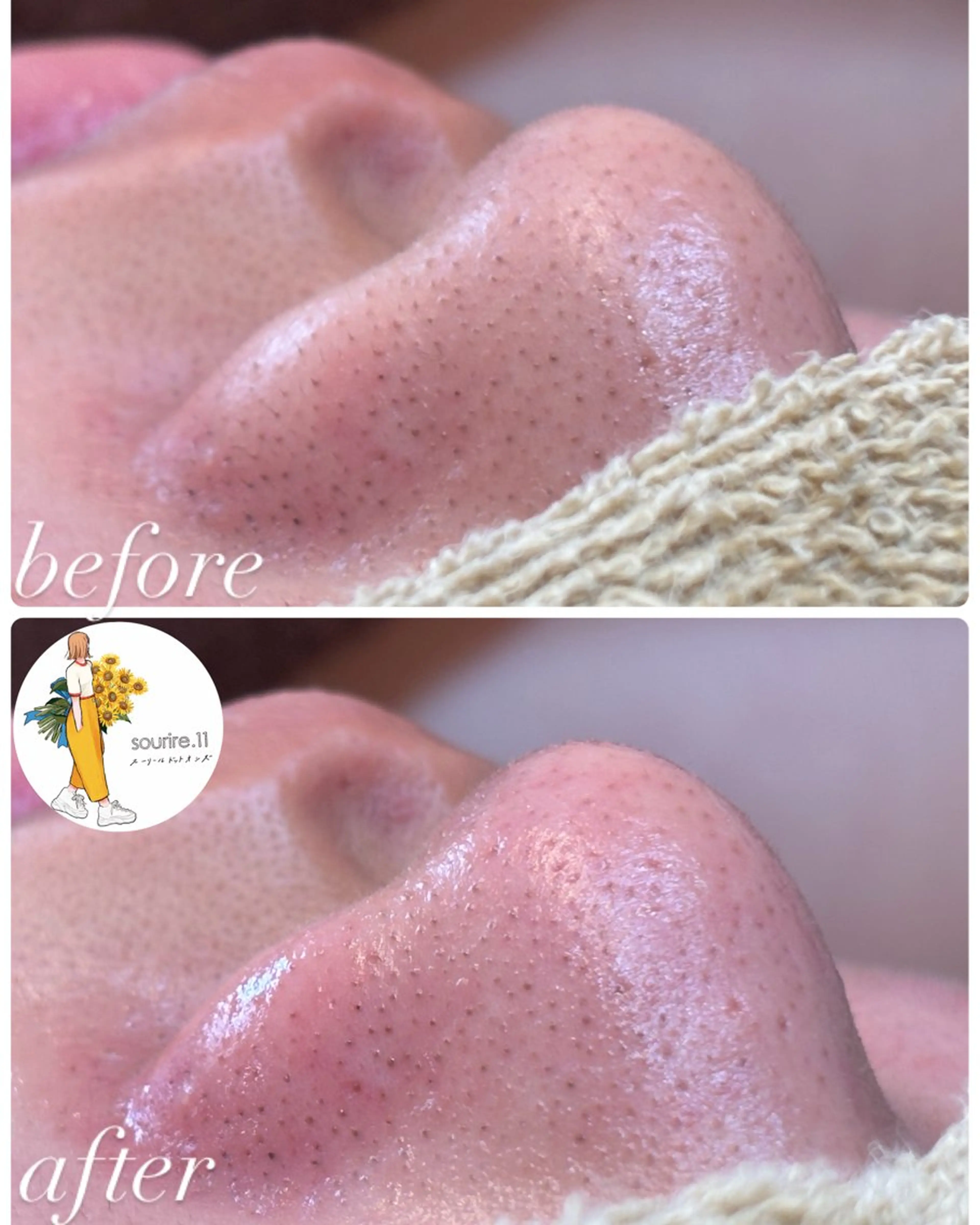 エステ sourire.11 ‪☺︎‬‪emiのその他イメージ