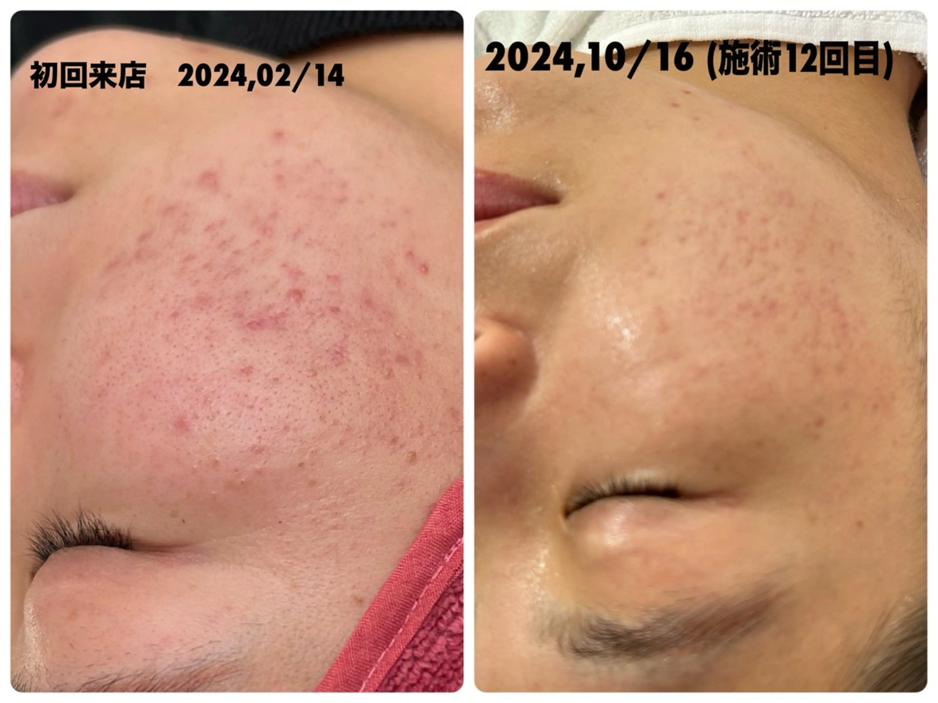 ÉMIA ✴︎のエステ・リラクイメージ