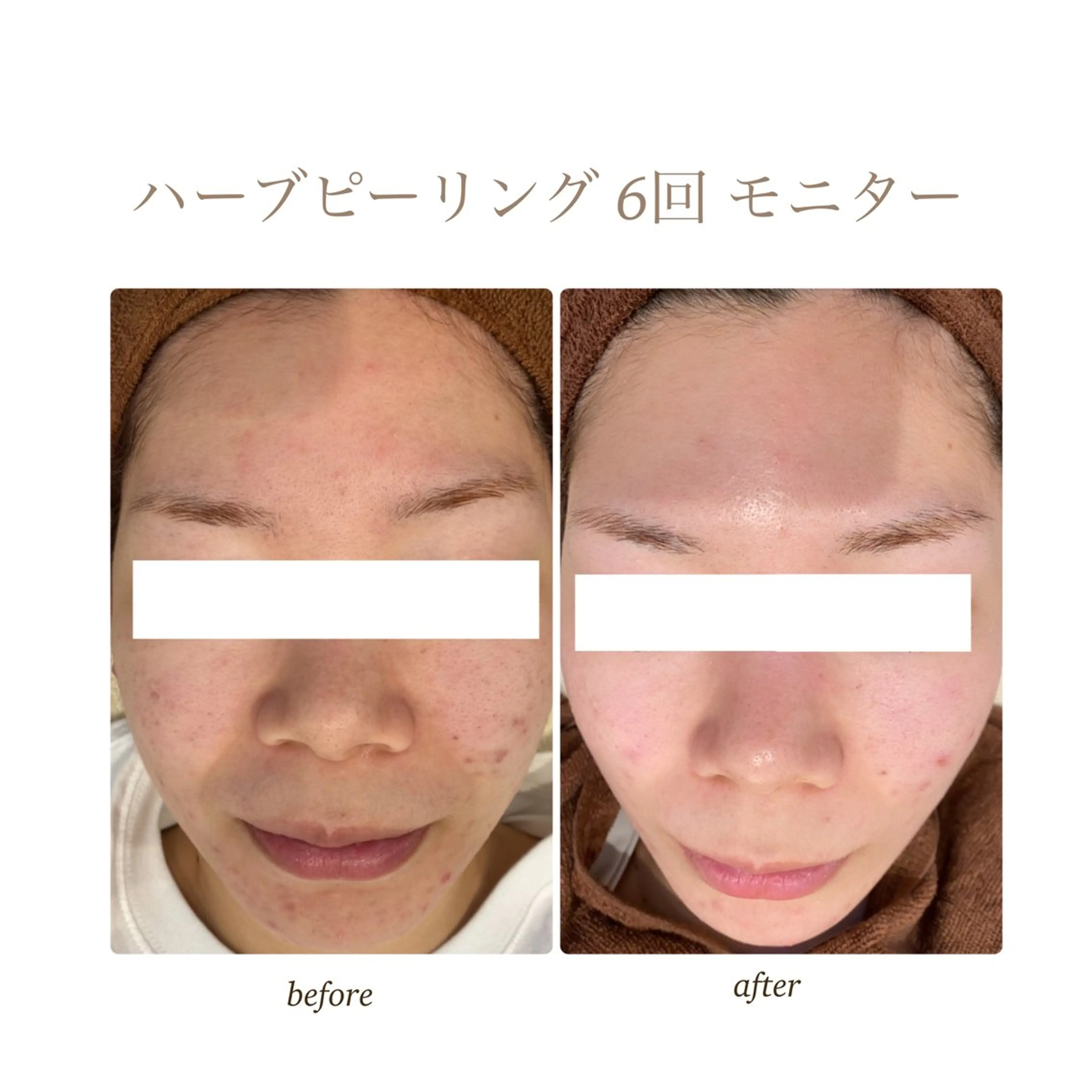 エステ リラク MAEDA .のエステ・リラクイメージ