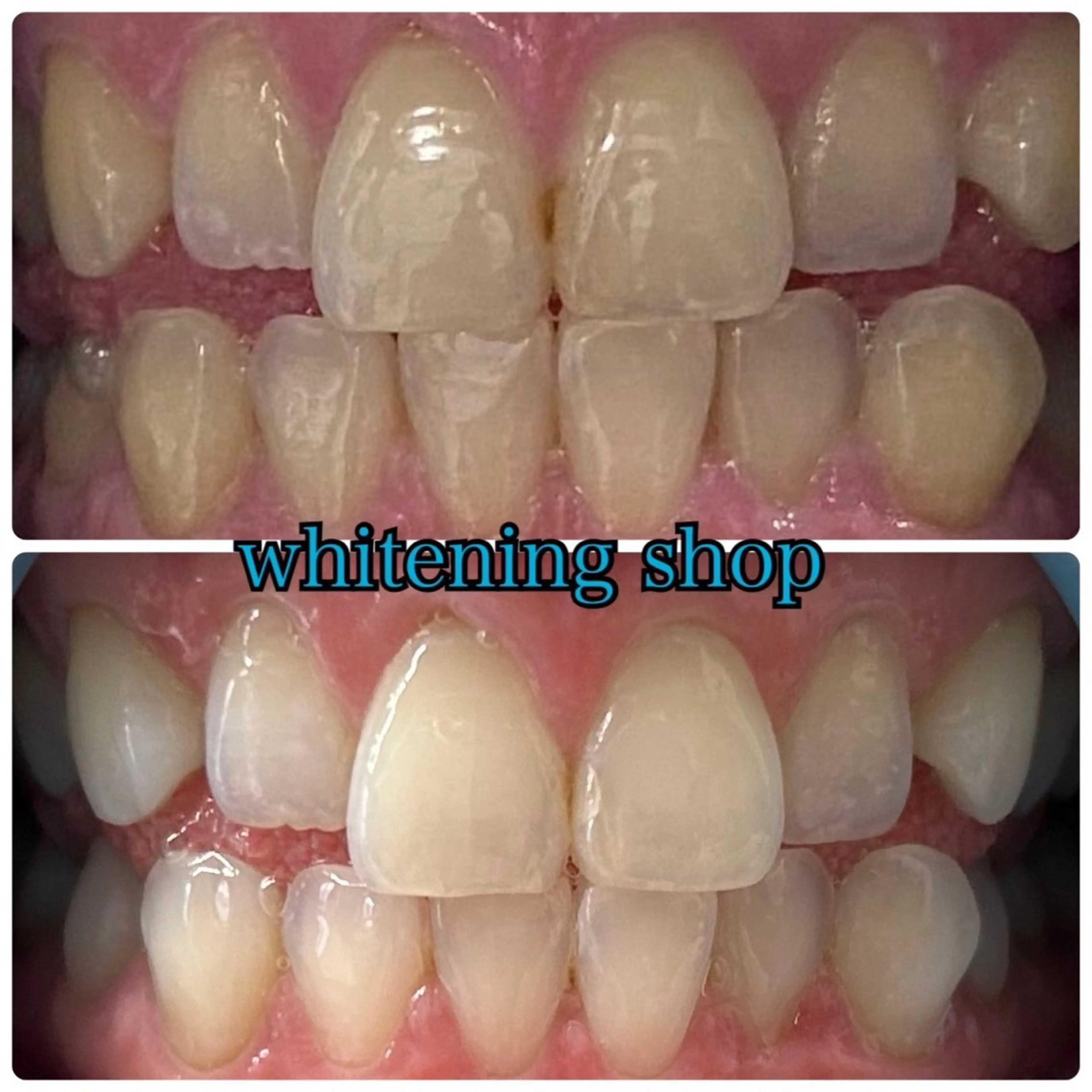 ホワイトニング ショップ津店のその他イメージ