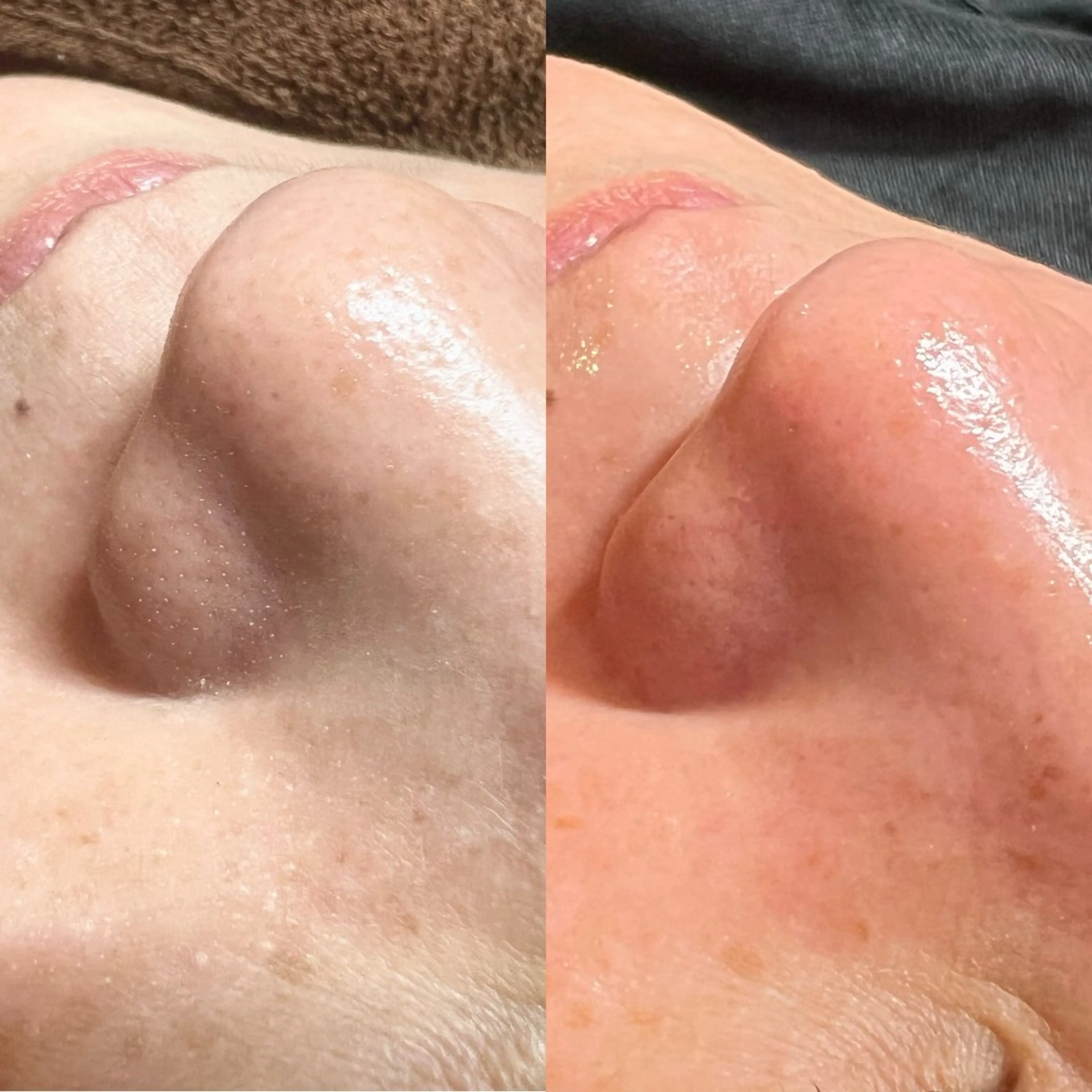 その他 PALM所属・PALM パームのマツエク・マツパデザイン