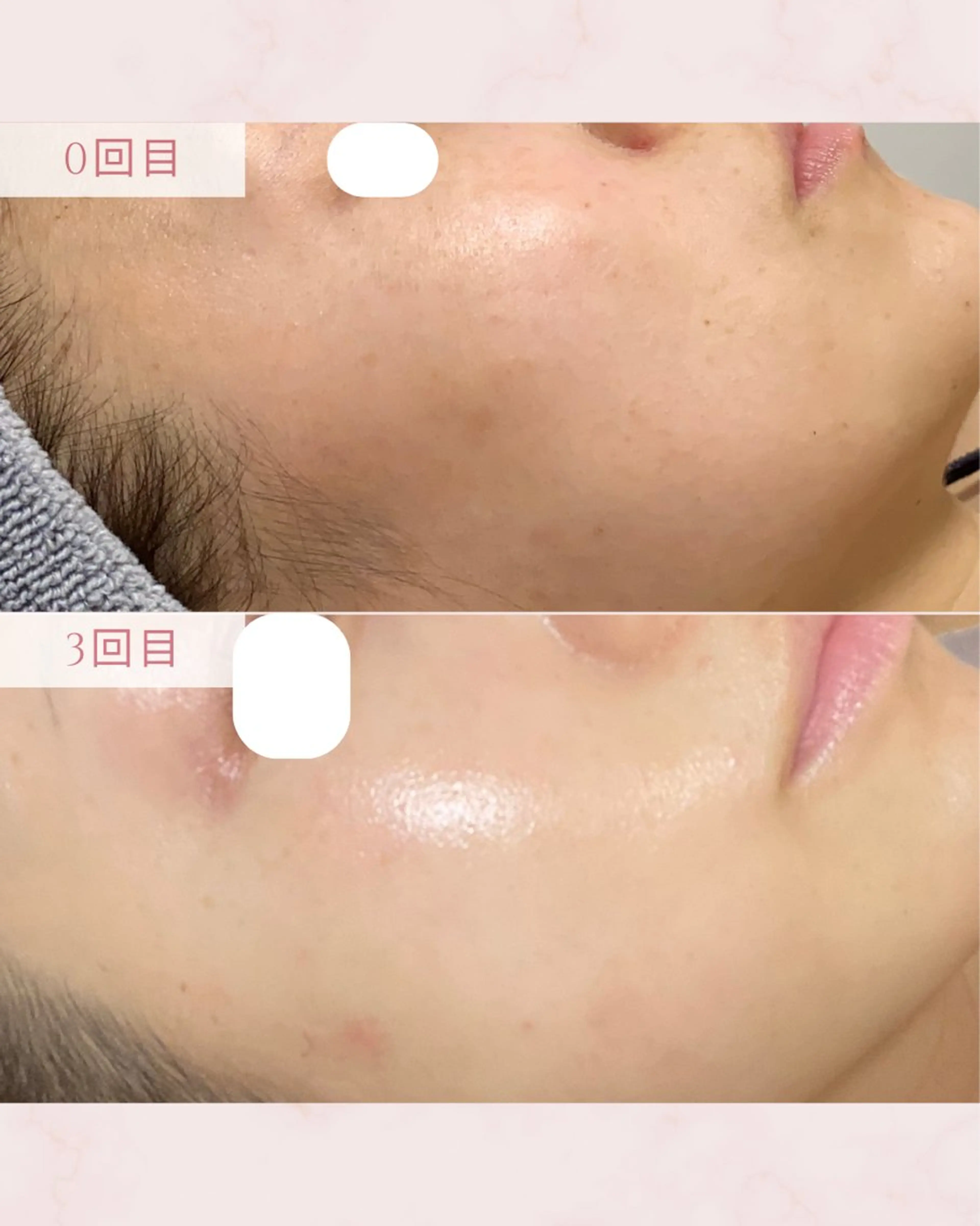 エステ MAUM-美 caresalon-のエステ・リラクイメージ