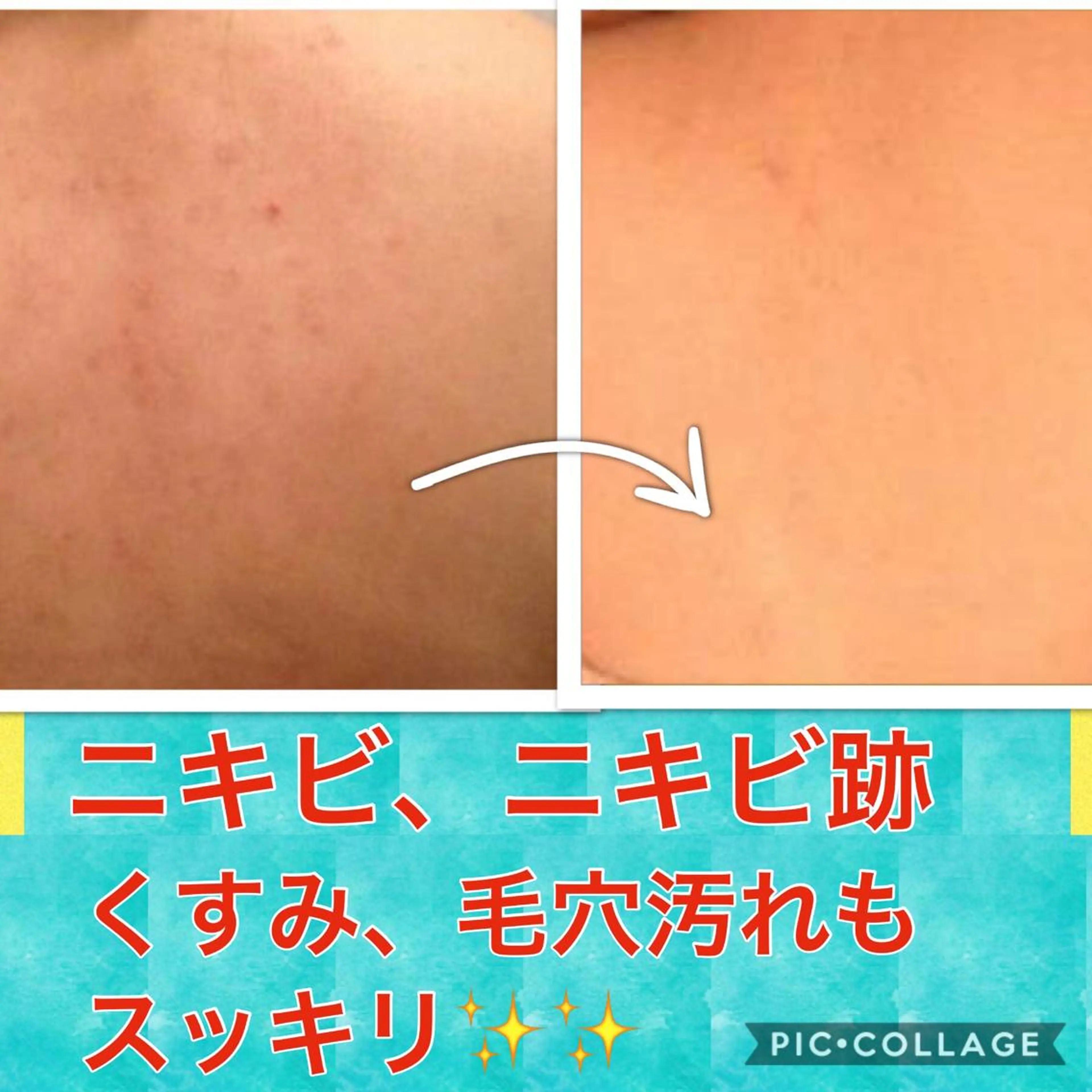 痩身リンパダイエット 隠れ家サロンチャームのエステ・リラクイメージ