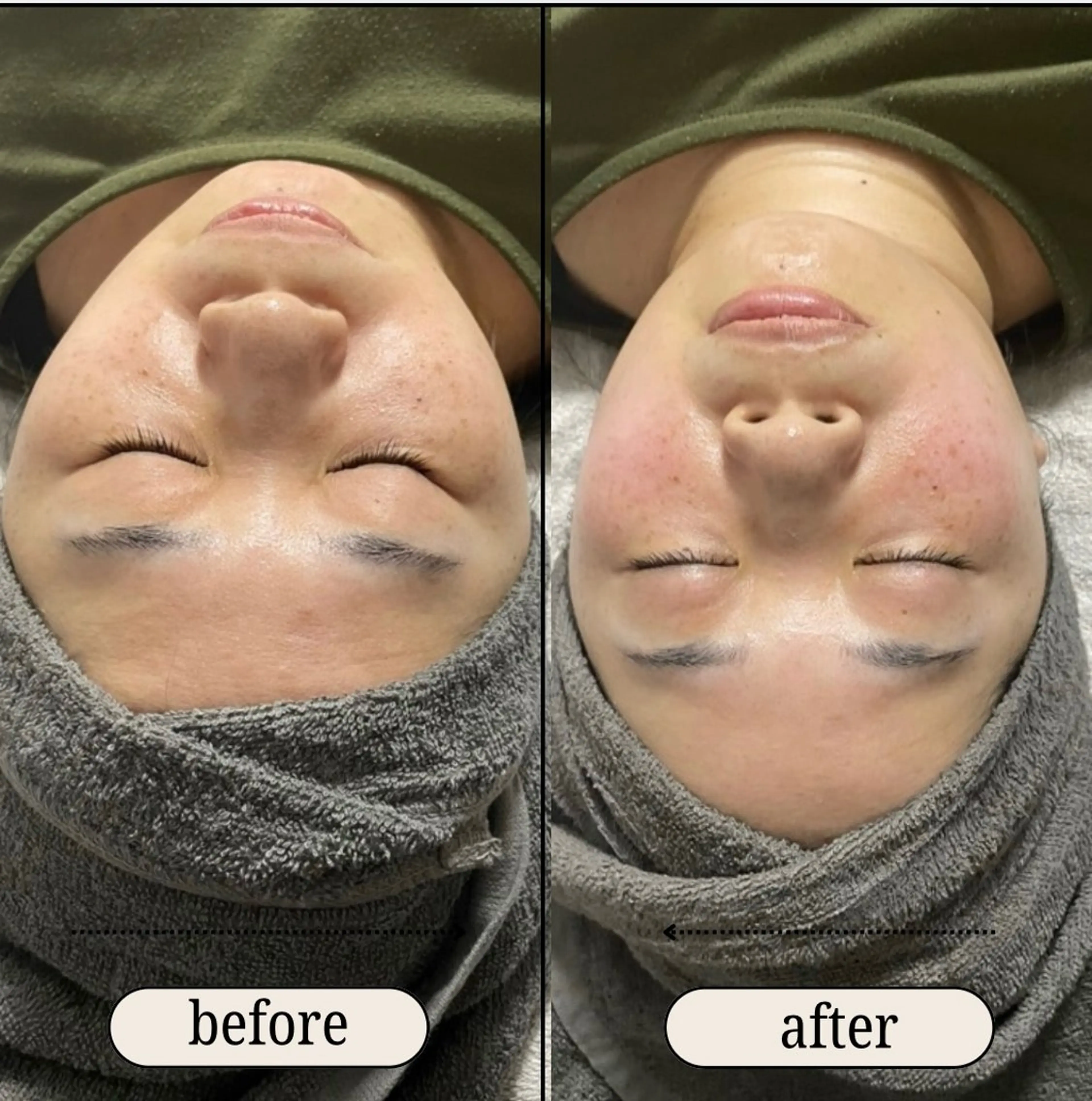 エステ リラク ele"ハーブ ピーリング 専門店のエステ・リラクイメージ