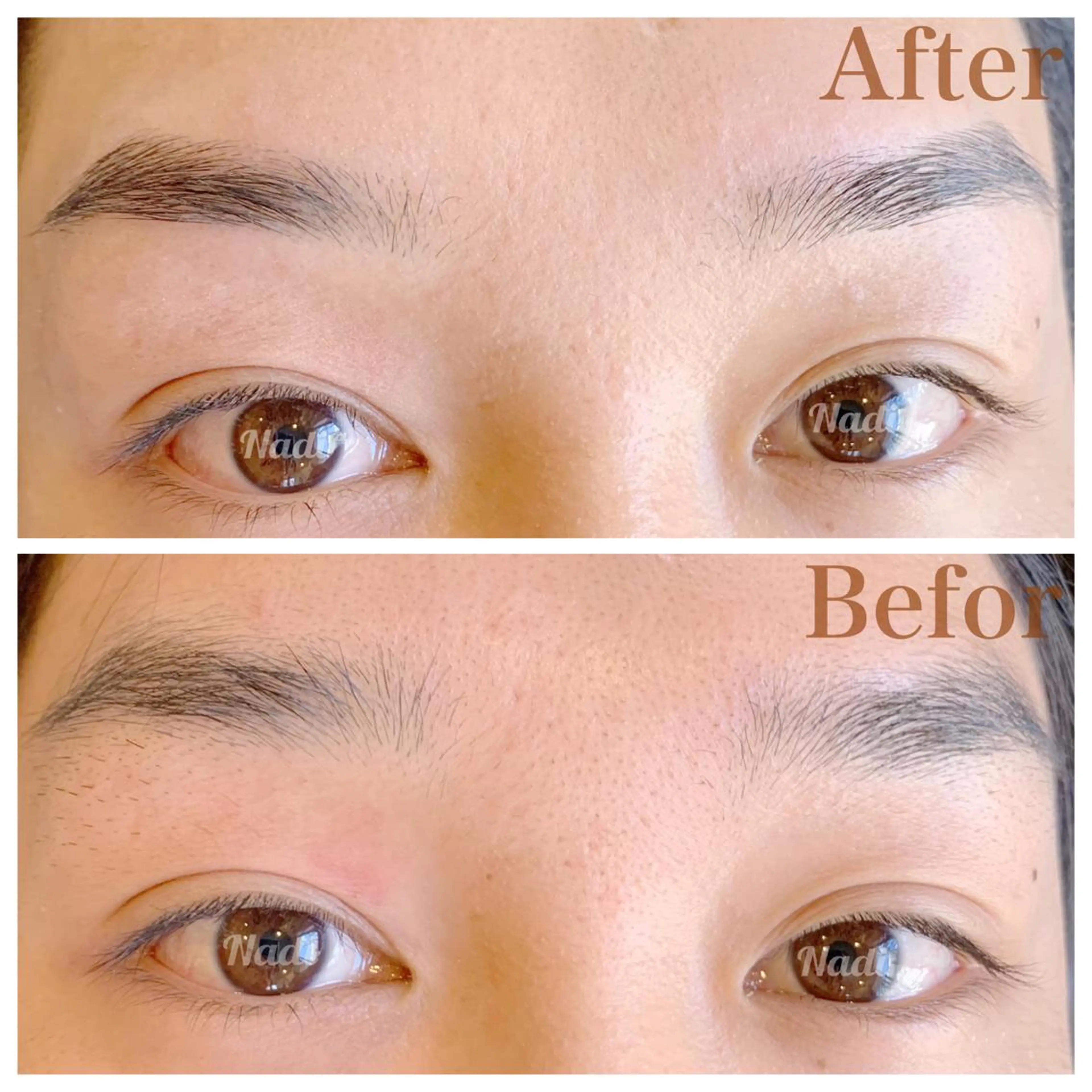 メンズ ハーブピーリング /KAEDEのエステ・リラクイメージ