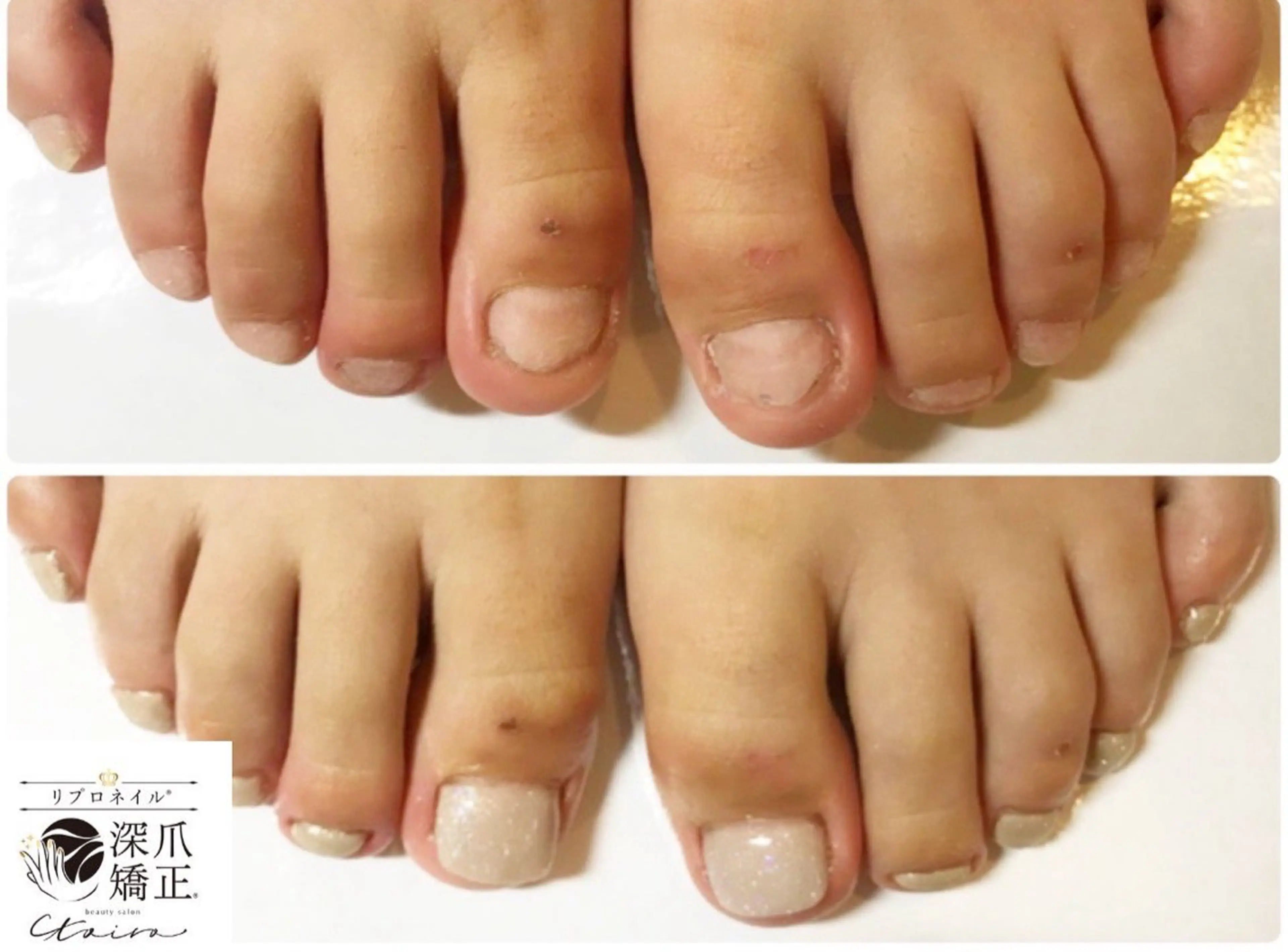 メンズ ネイル フットネイル ネイルサロン トイロのネイルデザイン