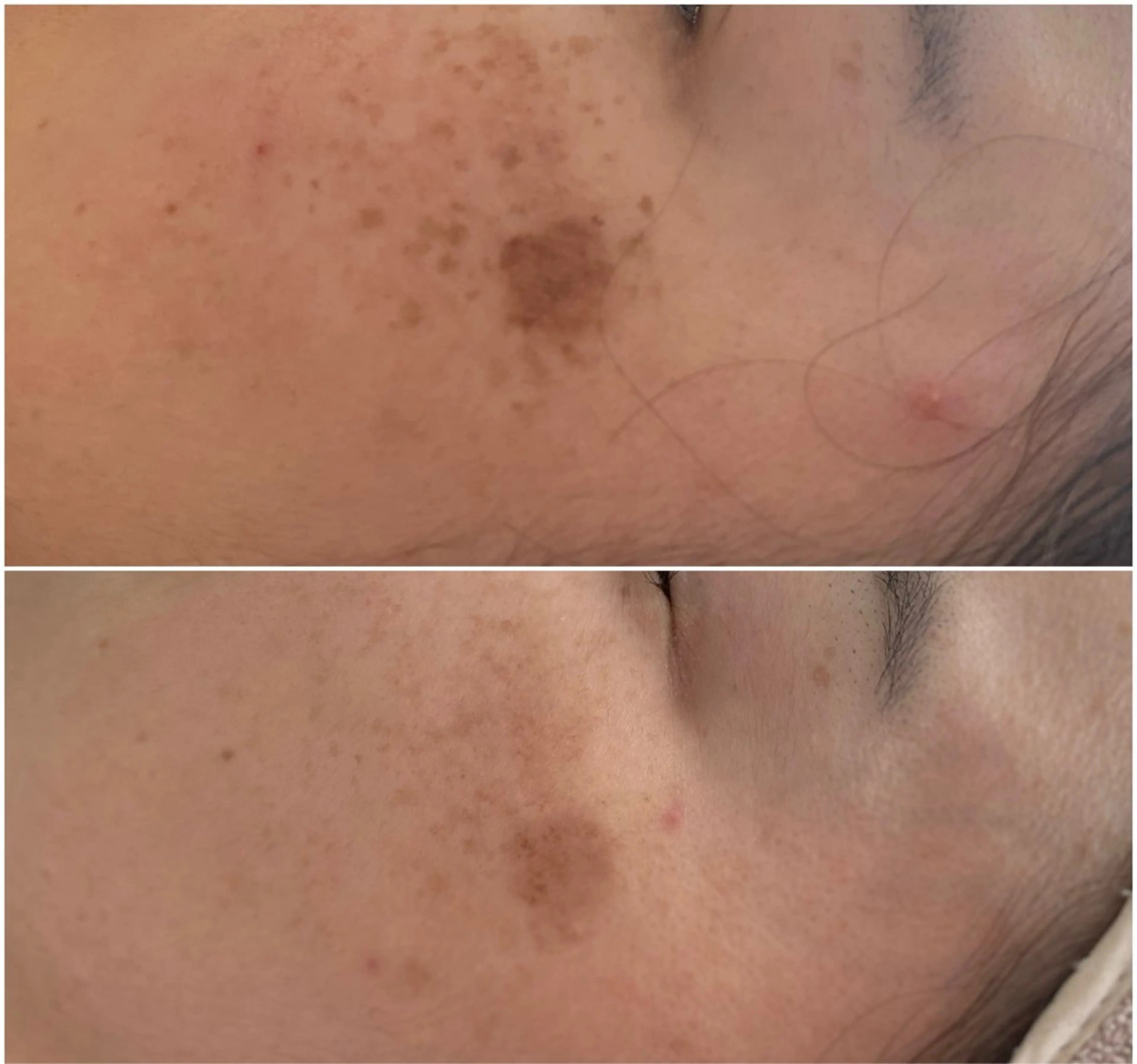 シミケア E Lashのエステ・リラクイメージ