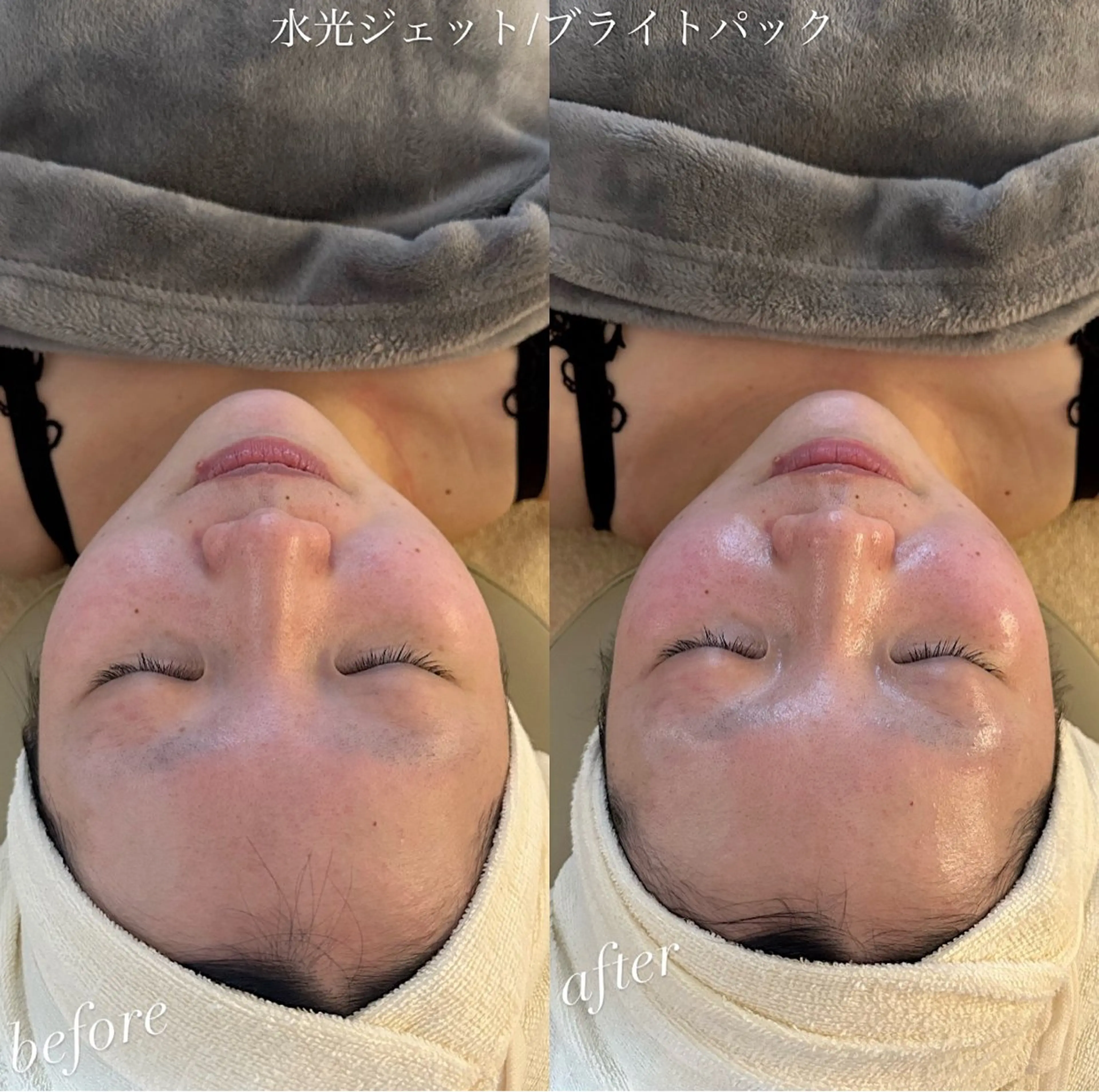 エステ うなじ脱毛/美肌脱毛 LABELのエステ・リラクイメージ