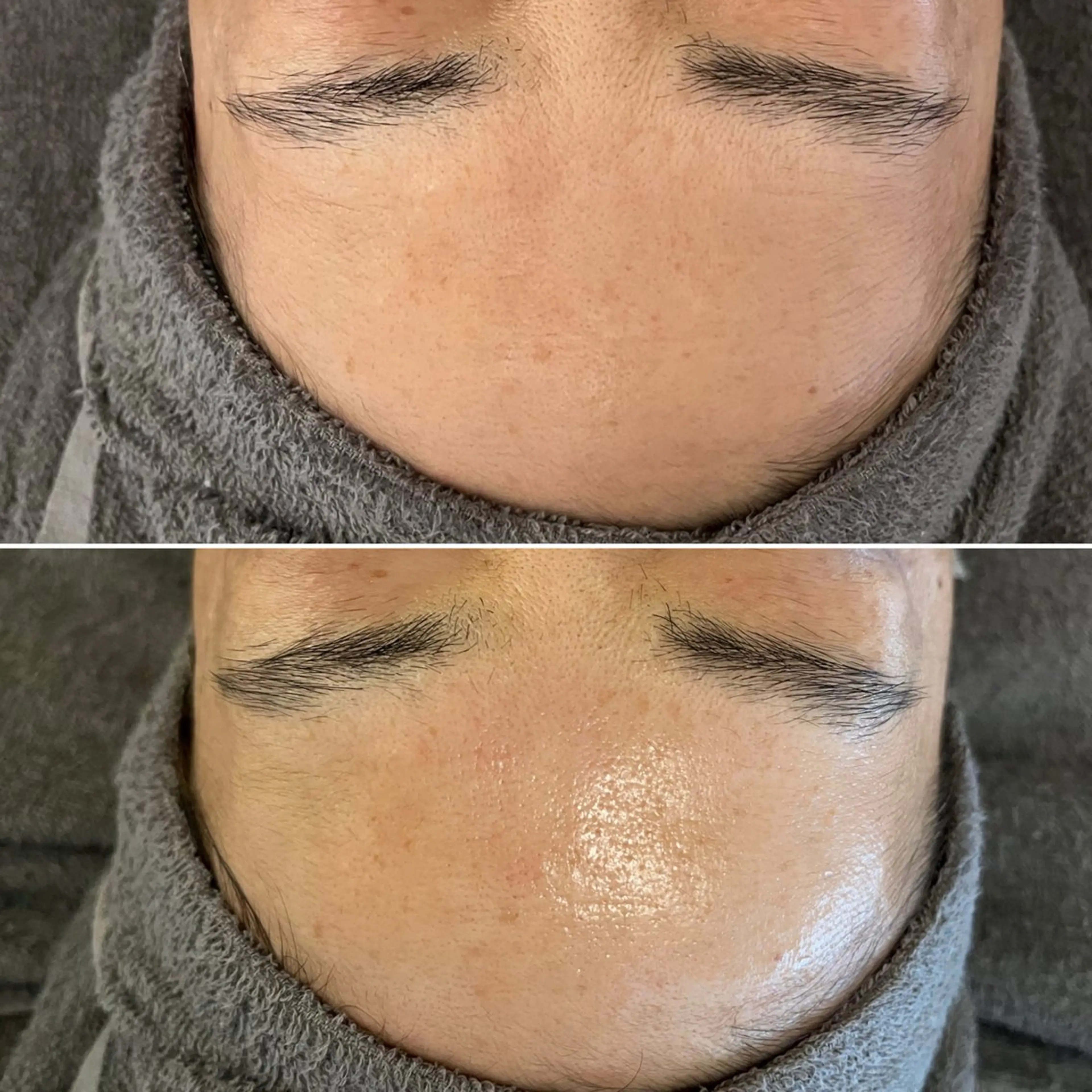 Blue Moon 【ブルームーン】のエステ・リラクイメージ