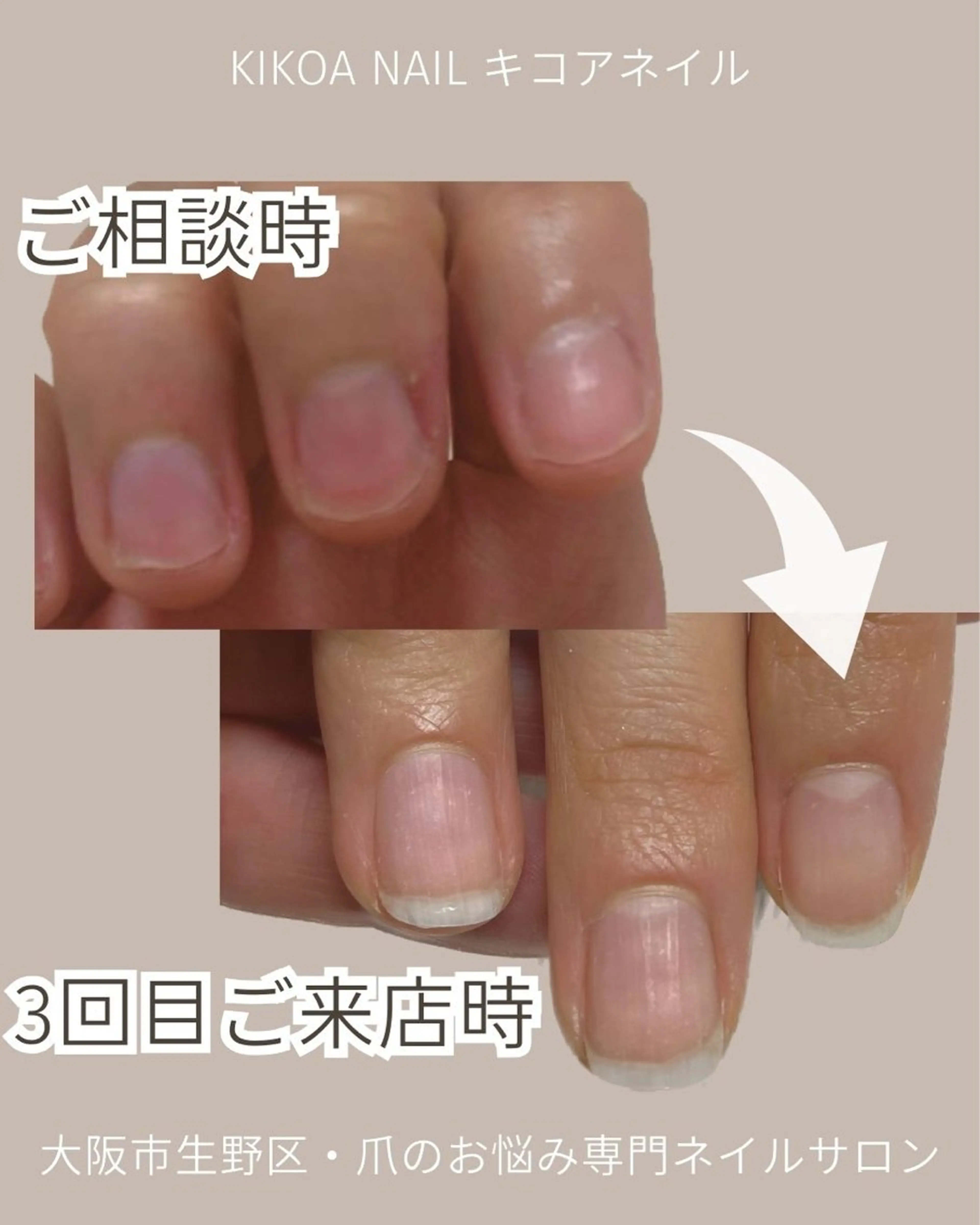 ネイル KIKOA NAIL キコアネイルのネイルデザイン