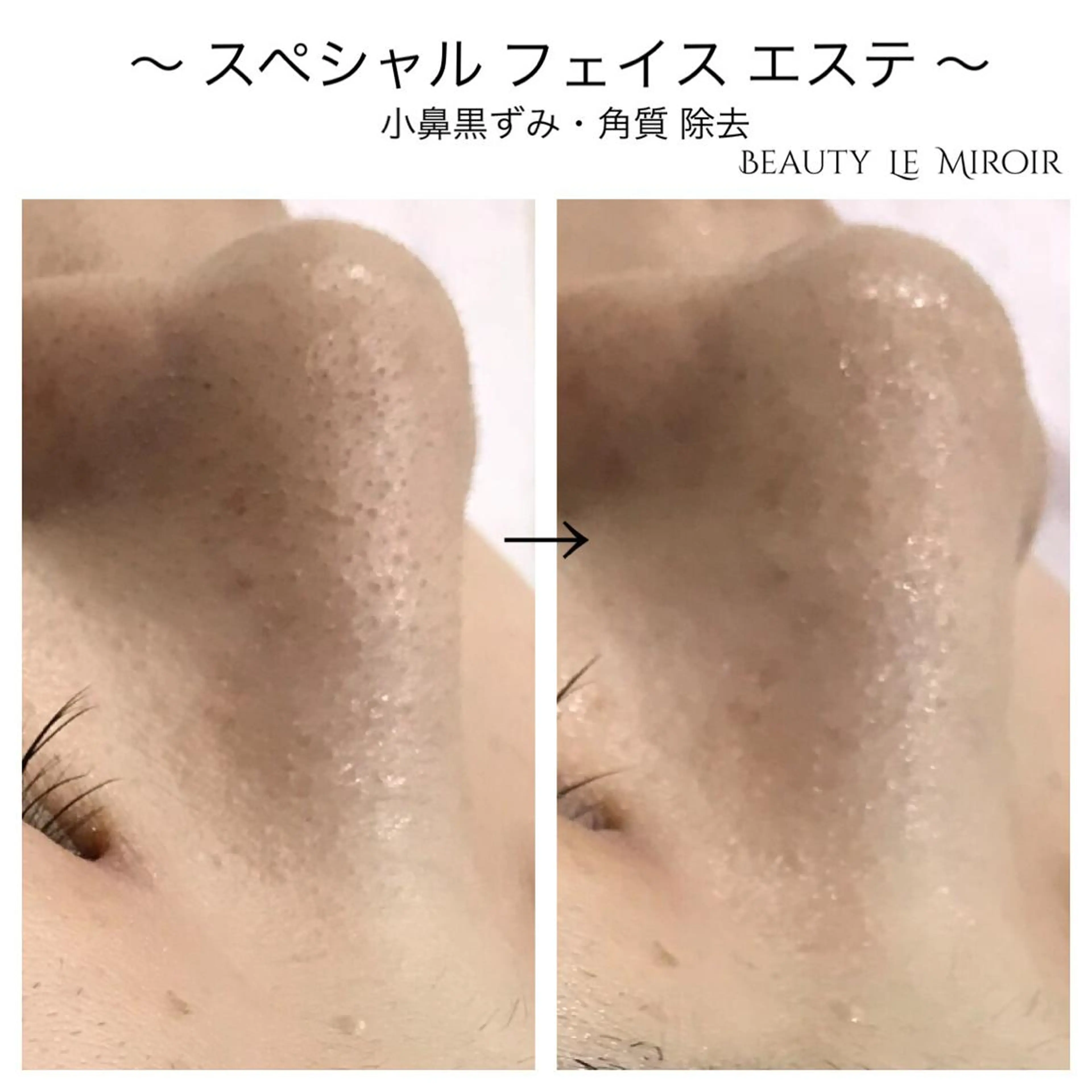 ビューティー ミロワールのエステ・リラクイメージ