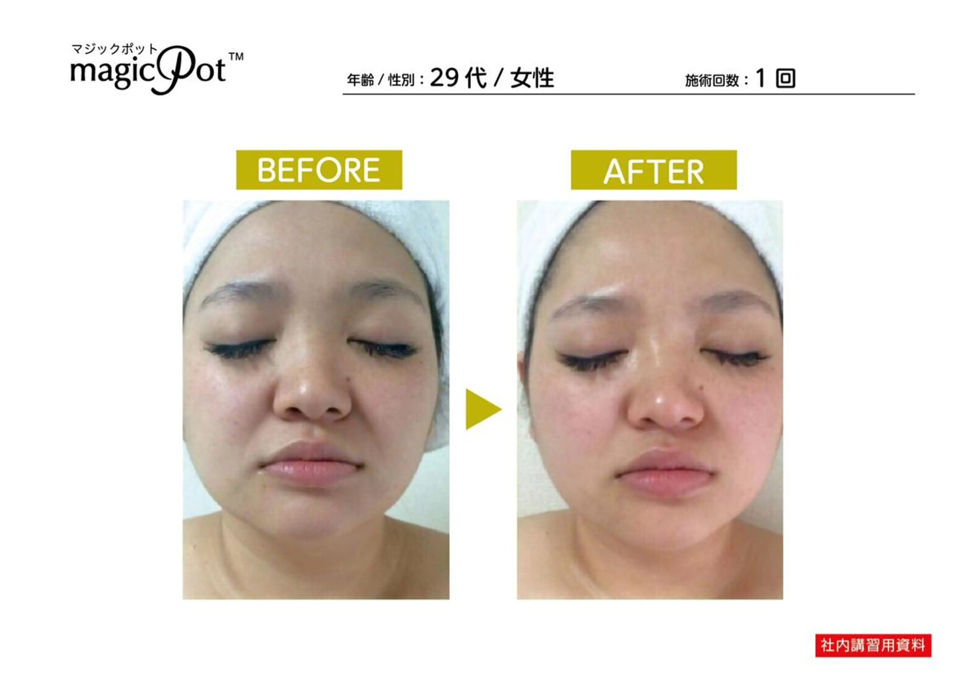 心斎橋痩身ダイエット 韓国.美容鍼.小顔のエステ・リラクイメージ