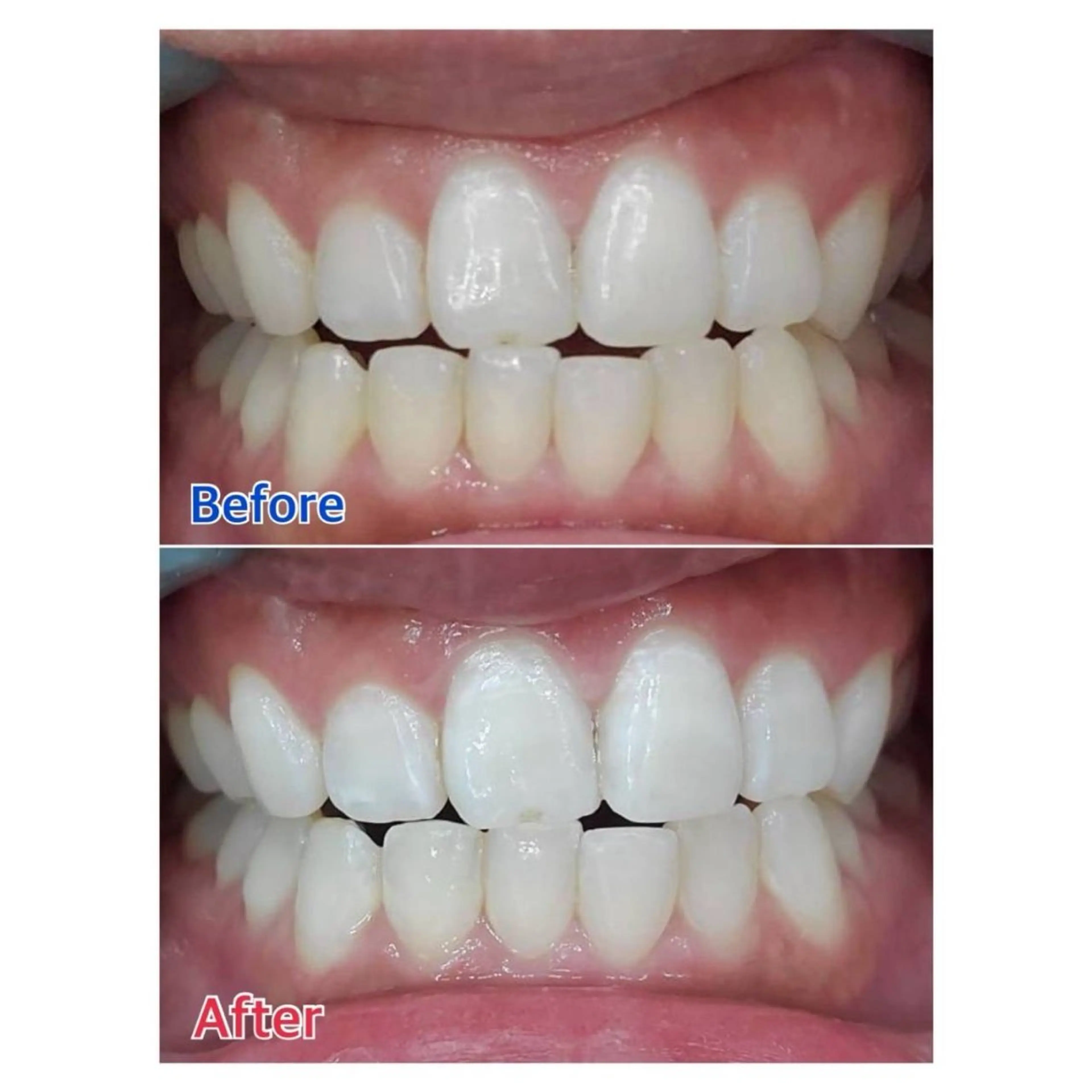 Melty 輝のその他イメージ