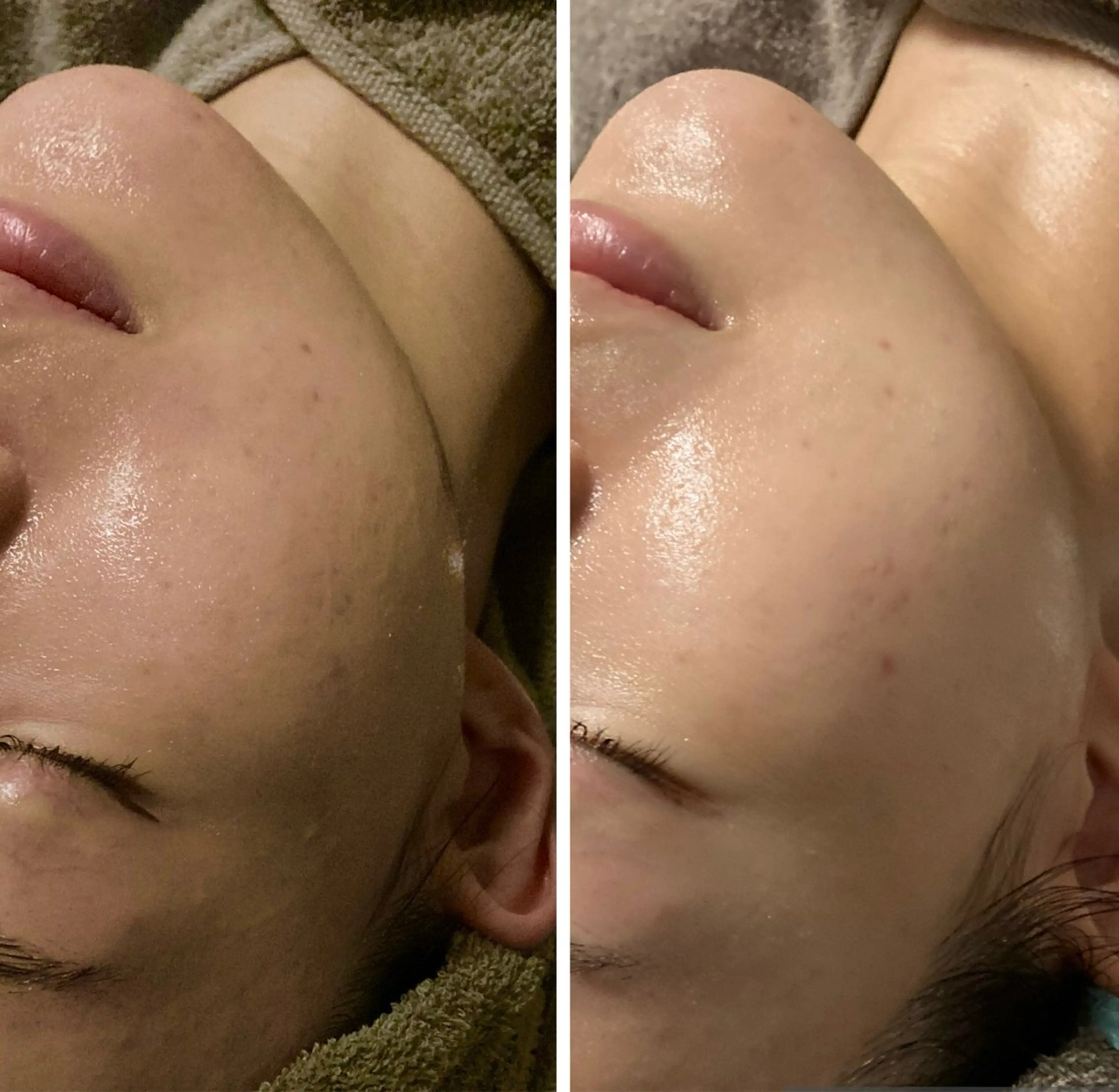 🌸期間限定🌸『新生活応援キャンペーン』メイクしたまま【小顔矯正】首から整えて小顔に☺️施術時間60分の写真