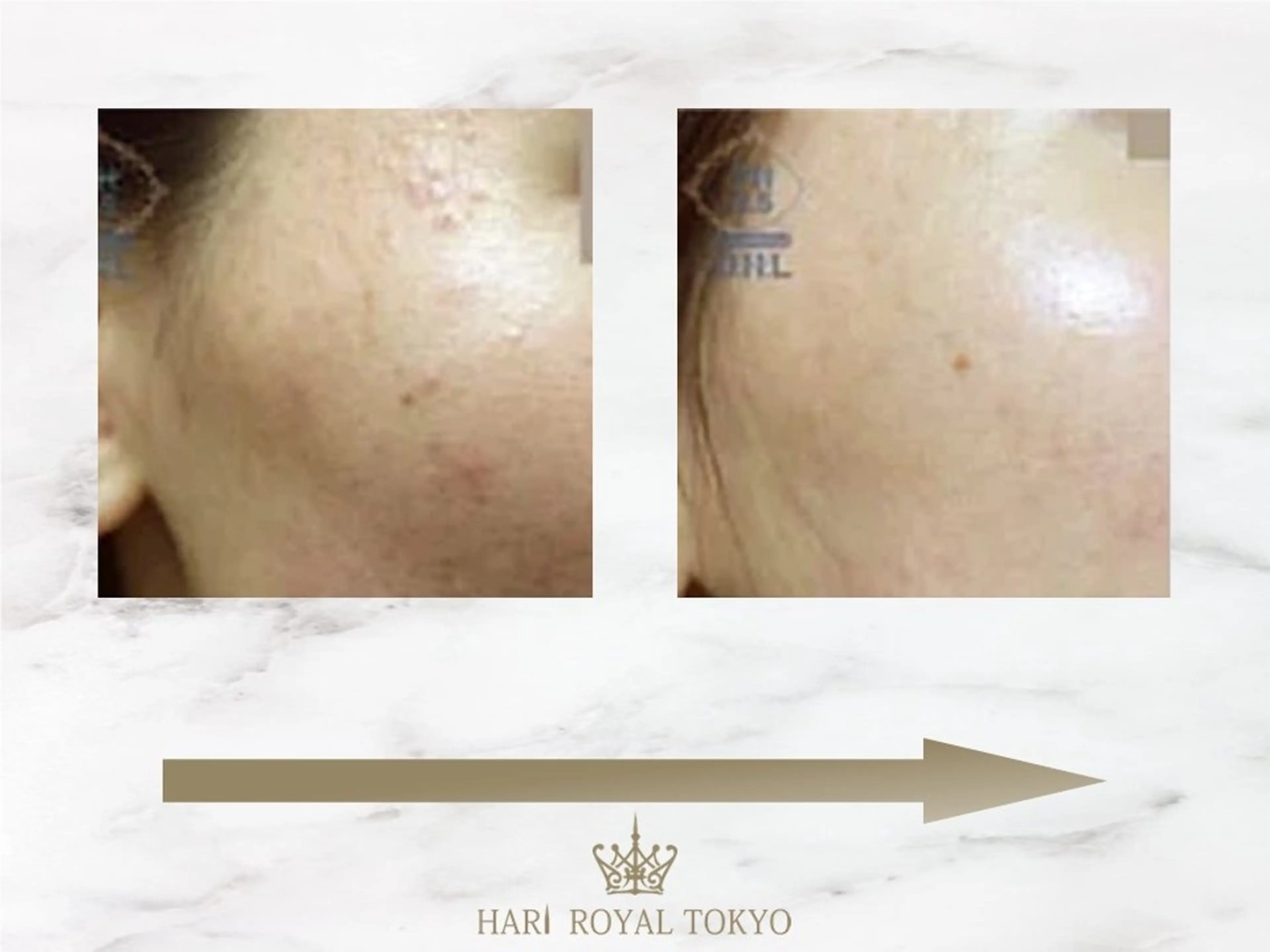 その他 ニューハーフ鍼灸師 🖤🤍Saya🌹のエステ・リラクイメージ