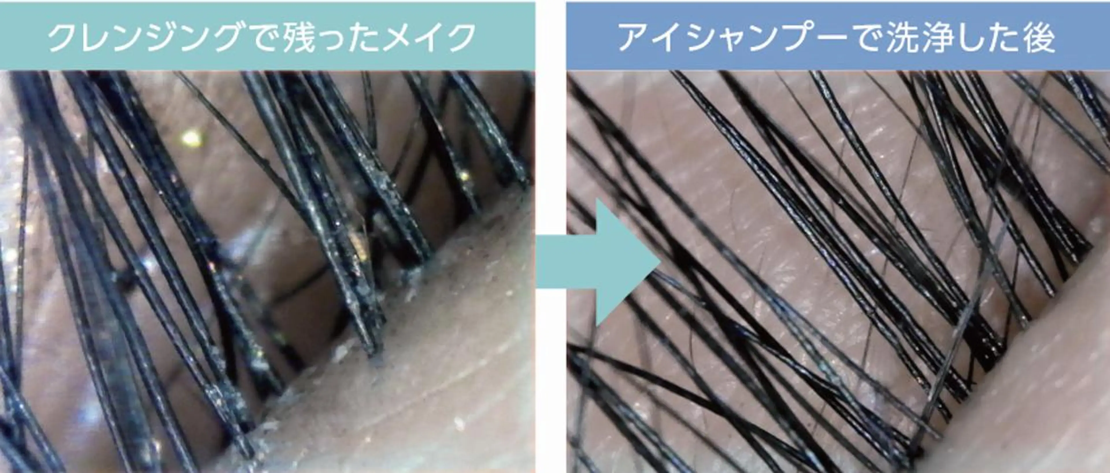 マツエク・マツパ Ali Beauty Salon 新小岩のマツエク・マツパデザイン