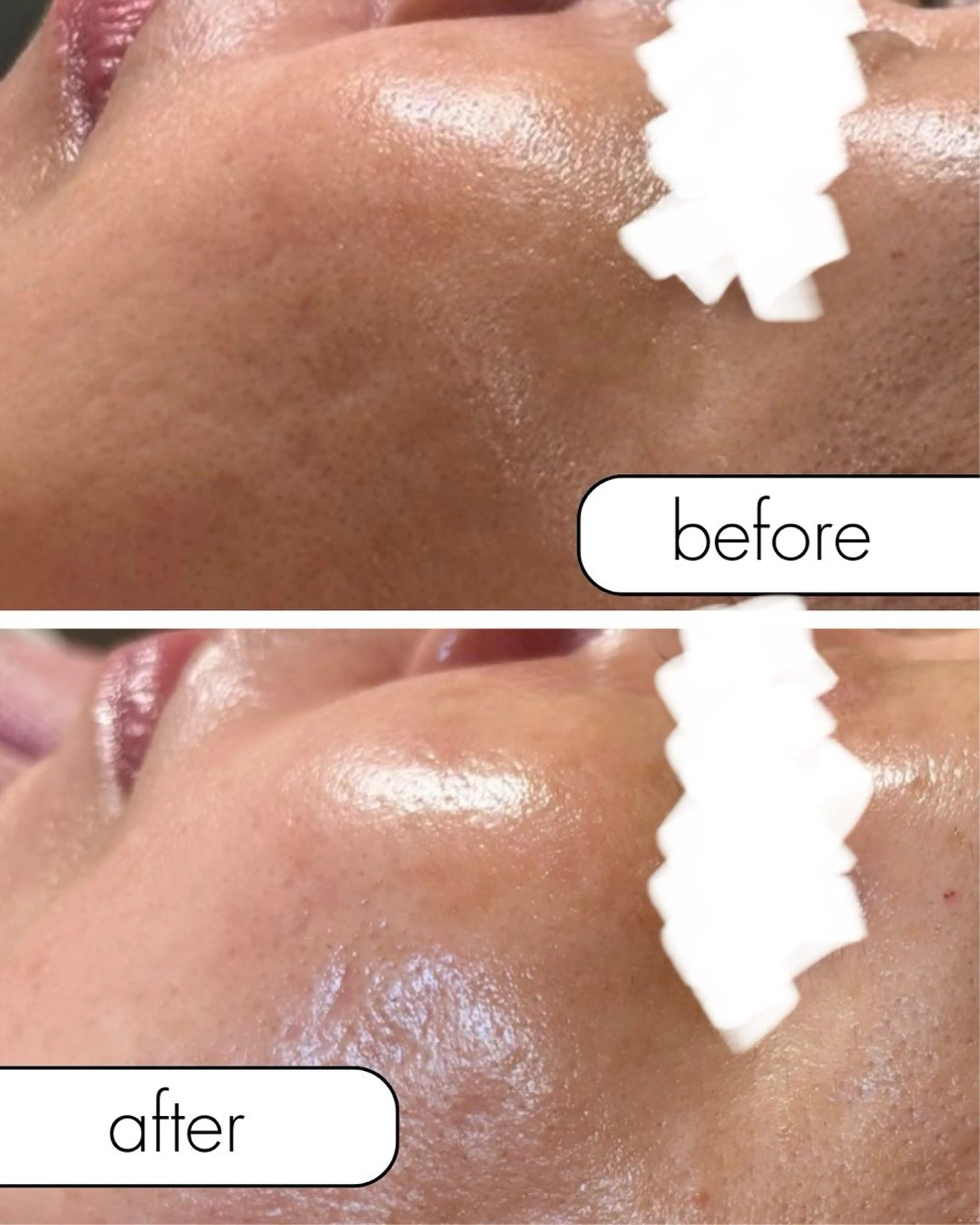 Ranan【ラナン】 chieのエステ・リラクイメージ