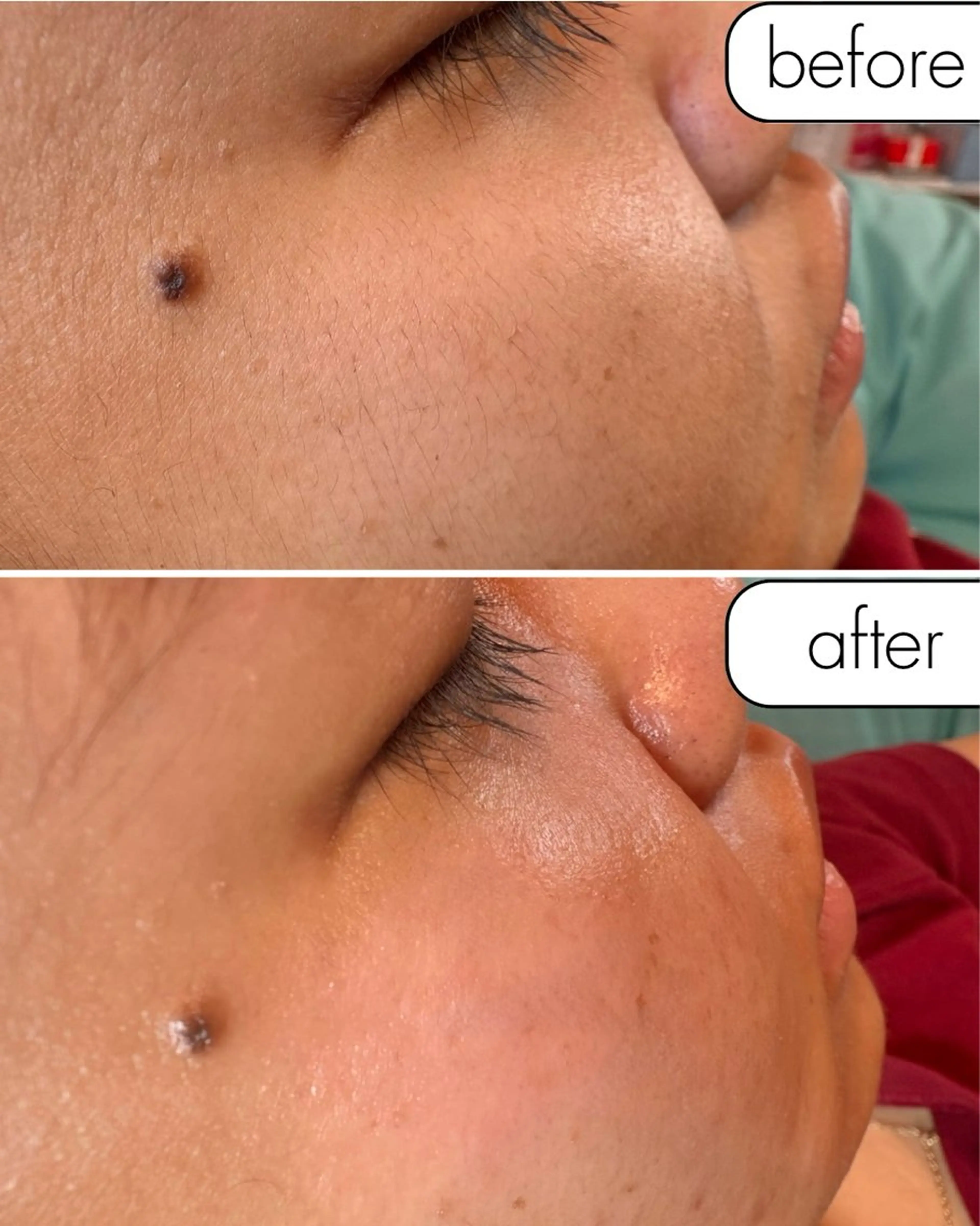 蝶式糸除毛専門salon aco所属・糸除毛専門salon acoのエステ・リラクイメージ