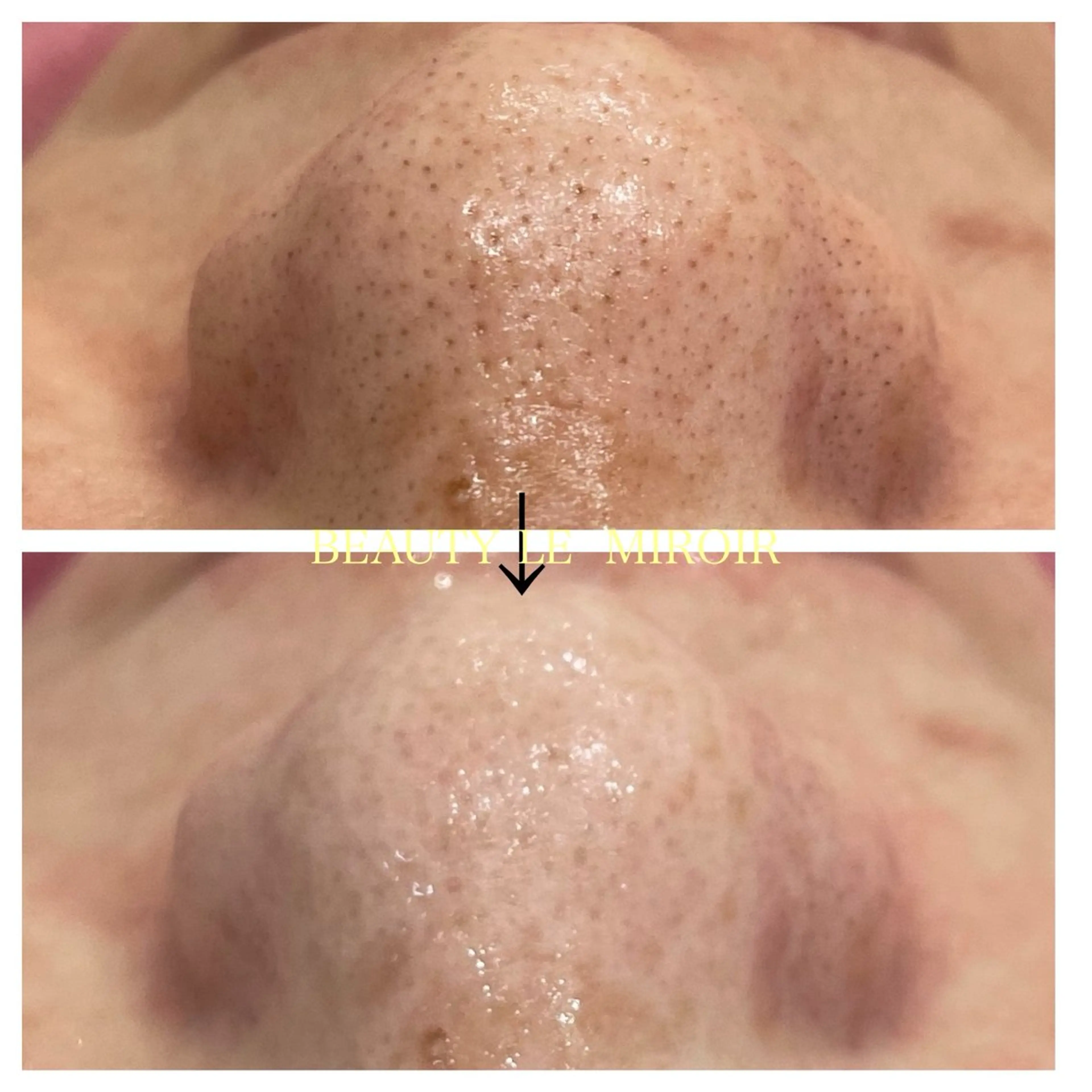 エステ ビューティー ミロワールのエステ・リラクイメージ