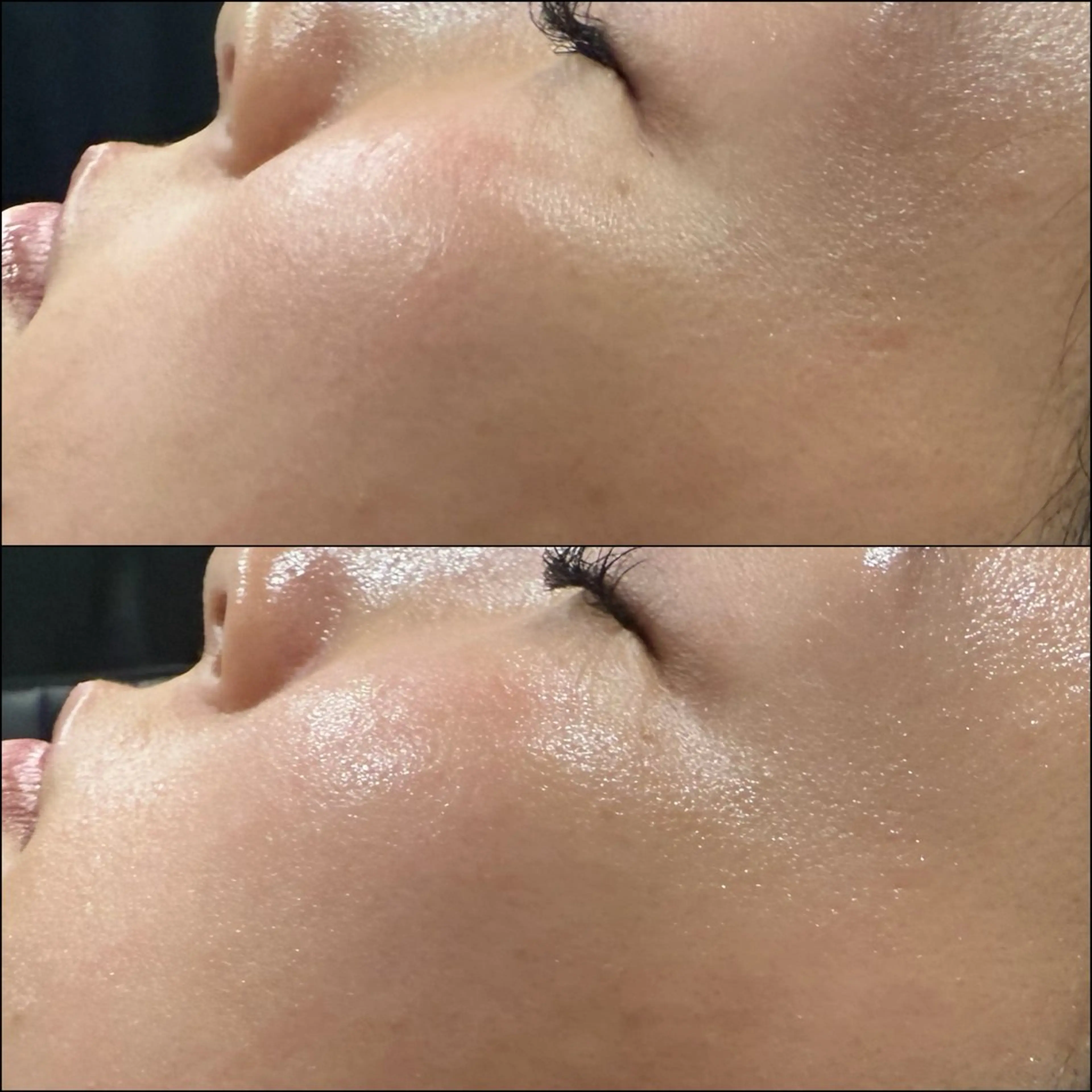 エステ LiZA エステティックサロンのエステ・リラクイメージ