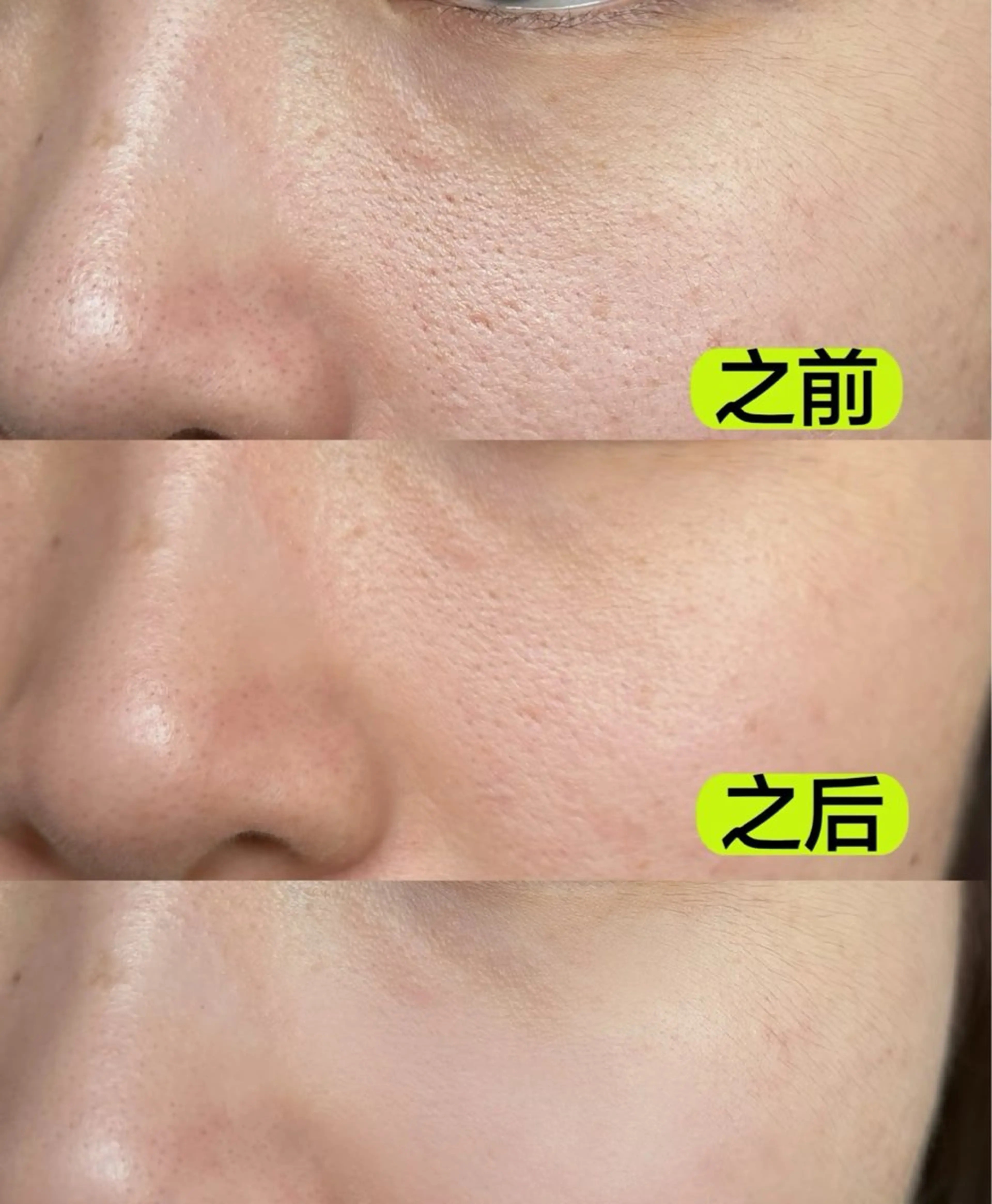 マツエク・マツパ エステ aliaハーブ水光店 エステティシャン募集のエステ・リラクイメージ