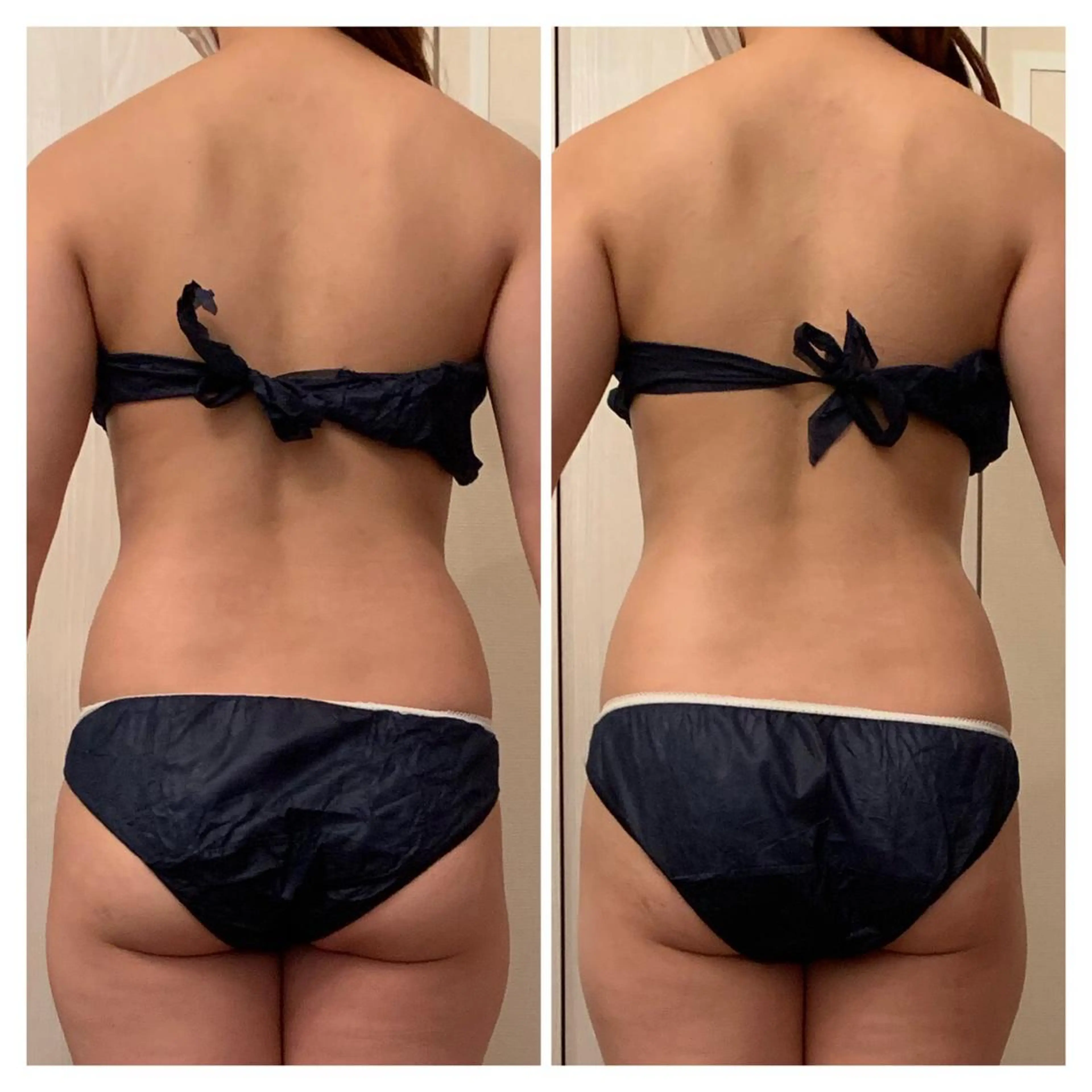 食べながら魅せボディ éclatJua川越のエステ・リラクイメージ