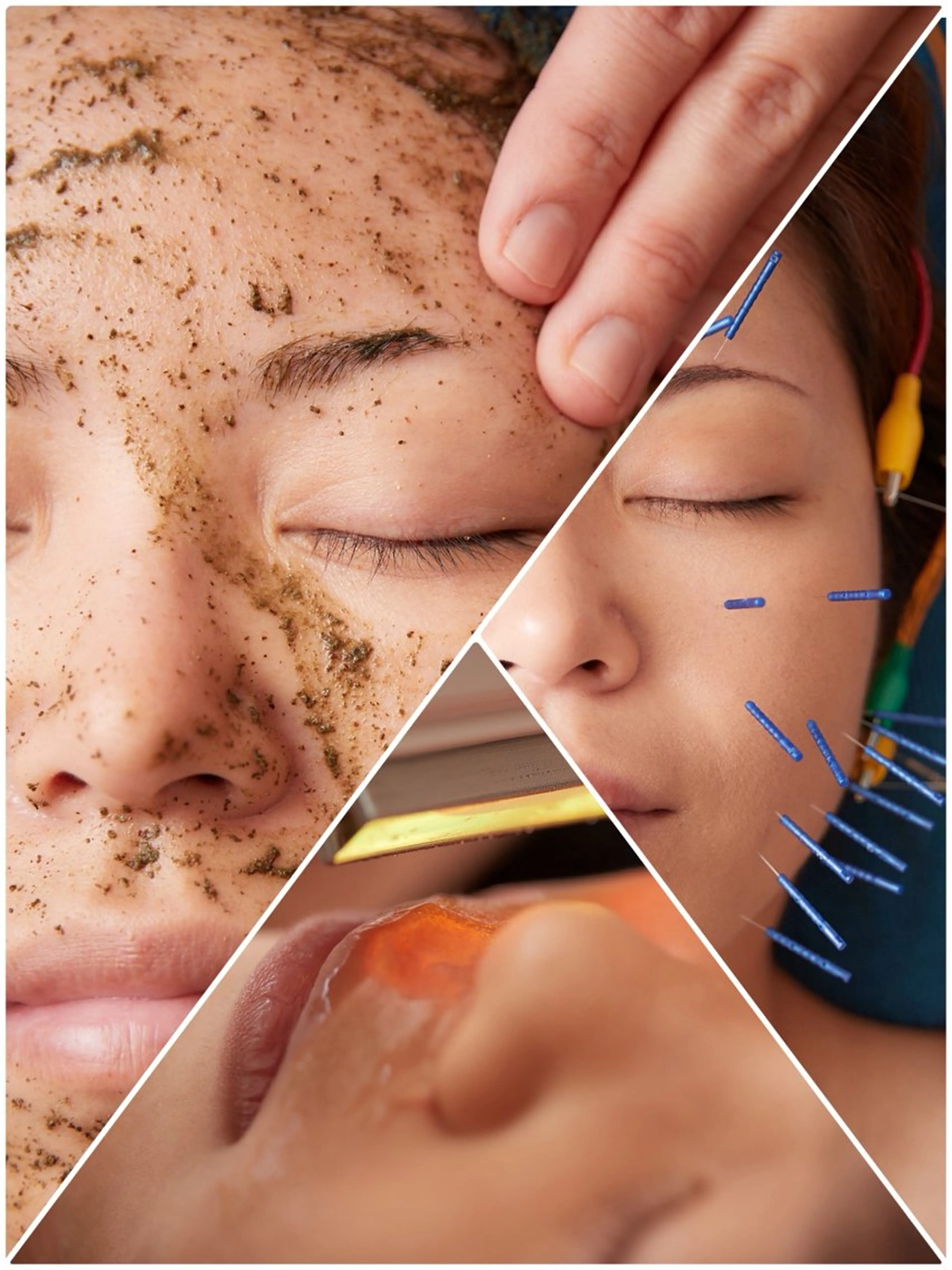 美楽鍼 びらくしんのその他イメージ