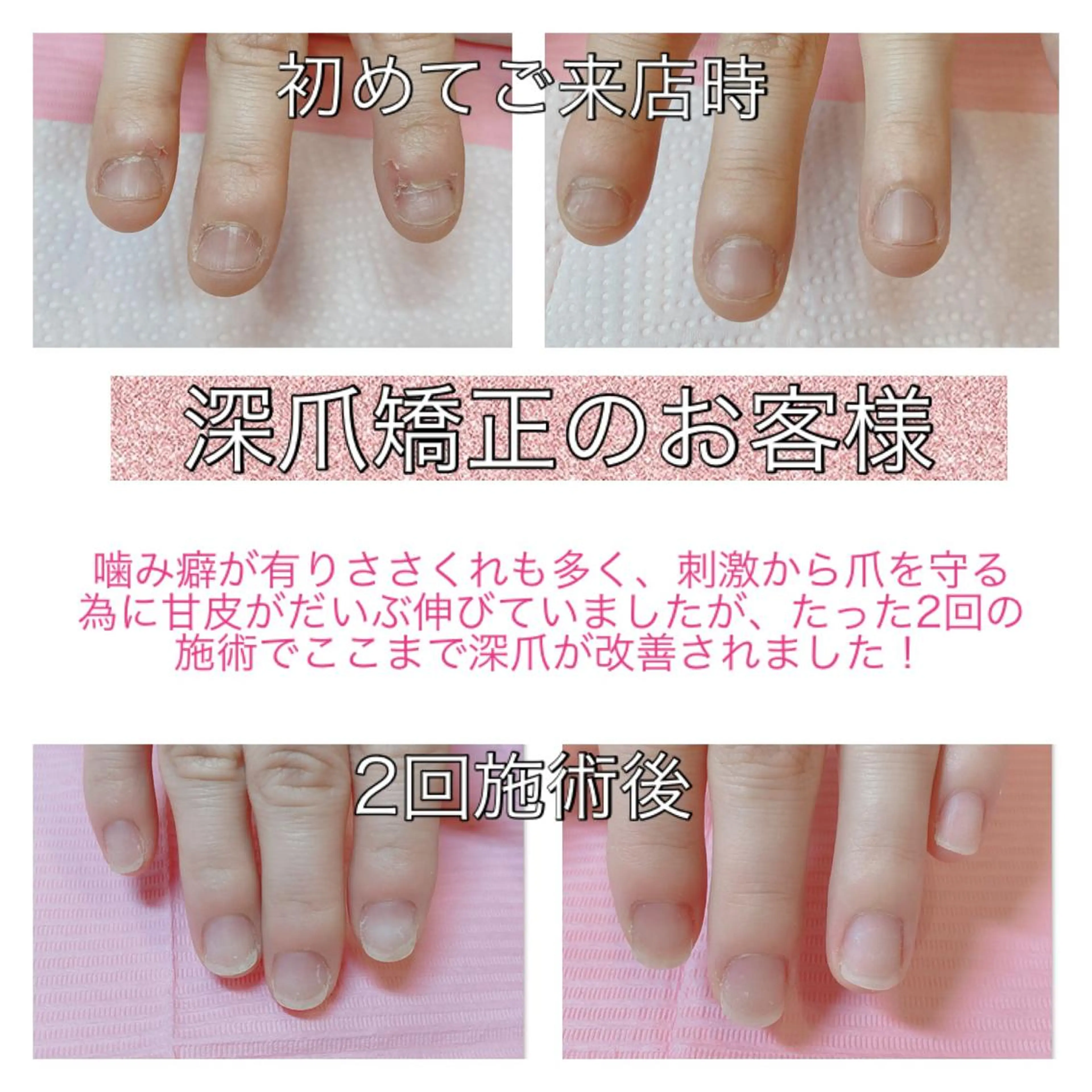 ネイル ハンドネイル 吉田 佳代子のネイルデザイン