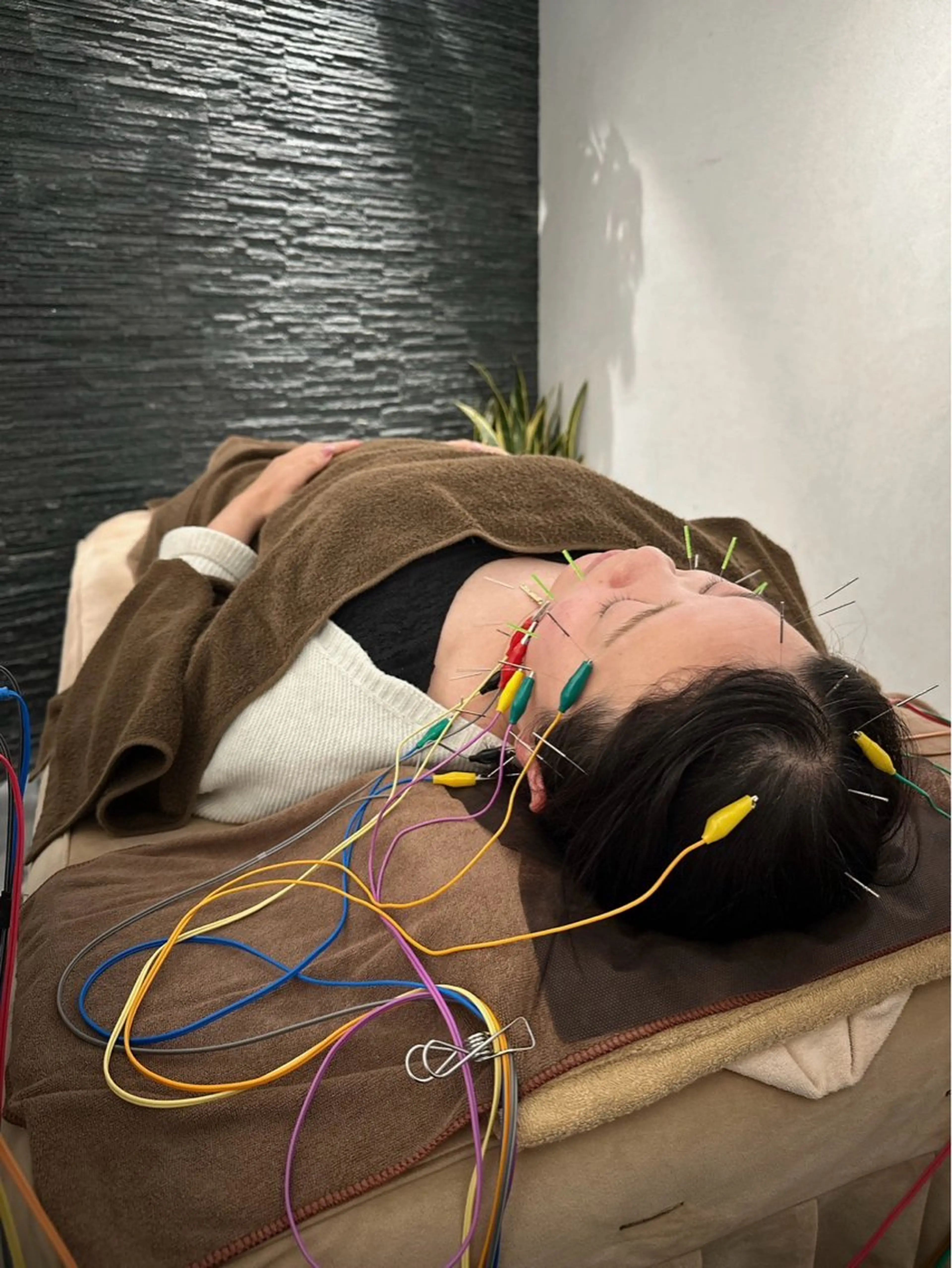 その他 美容鍼灸整体サロンBeauJu所属・小顔矯/美容鍼/鍼灸 BeauJuのその他イメージ