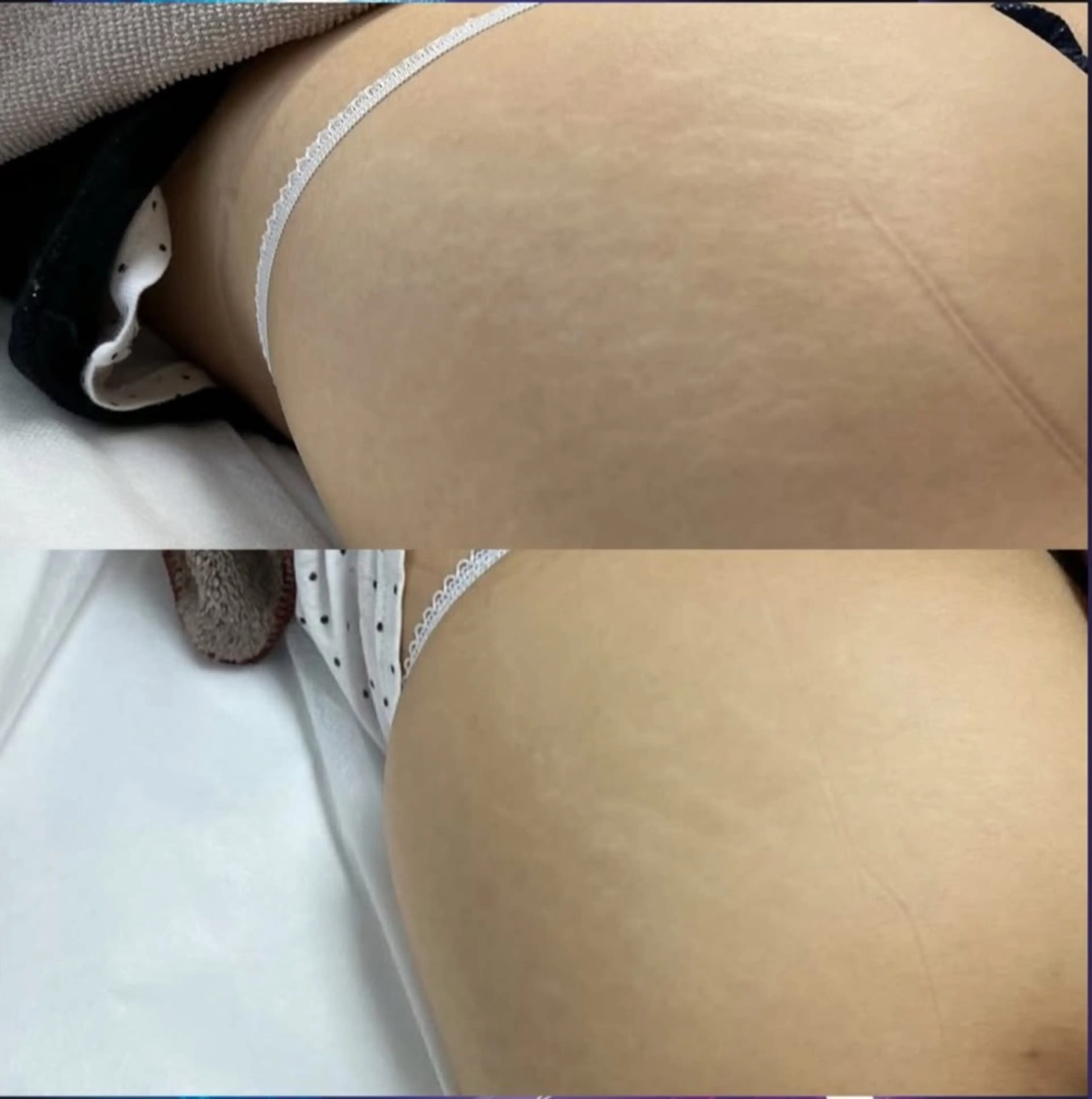 Blooming所属・LOUISE. ／肌質・頭皮のエステ・リラクイメージ