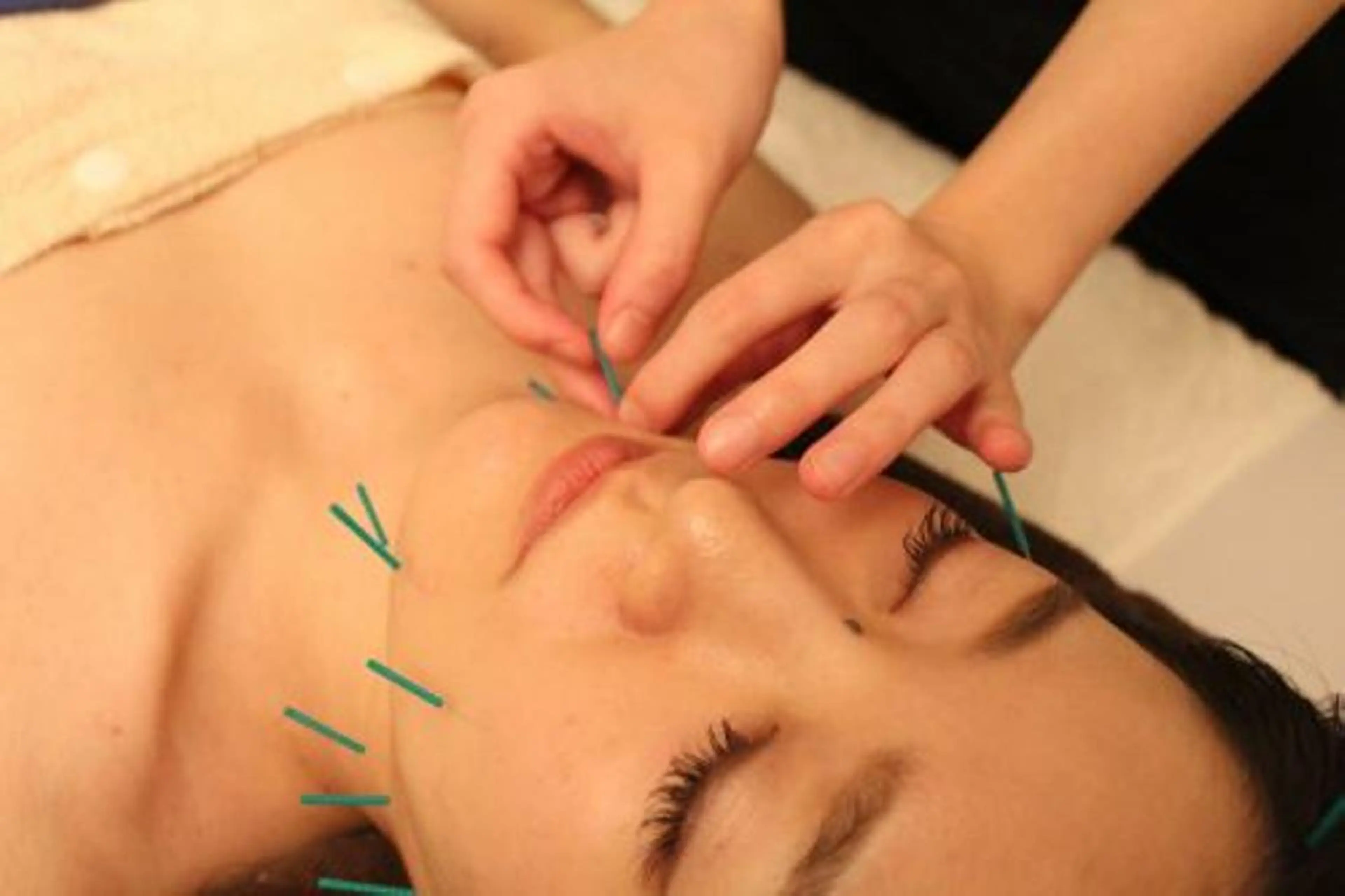 小顔矯正・美容鍼 美鍼堂のエステ・リラクイメージ