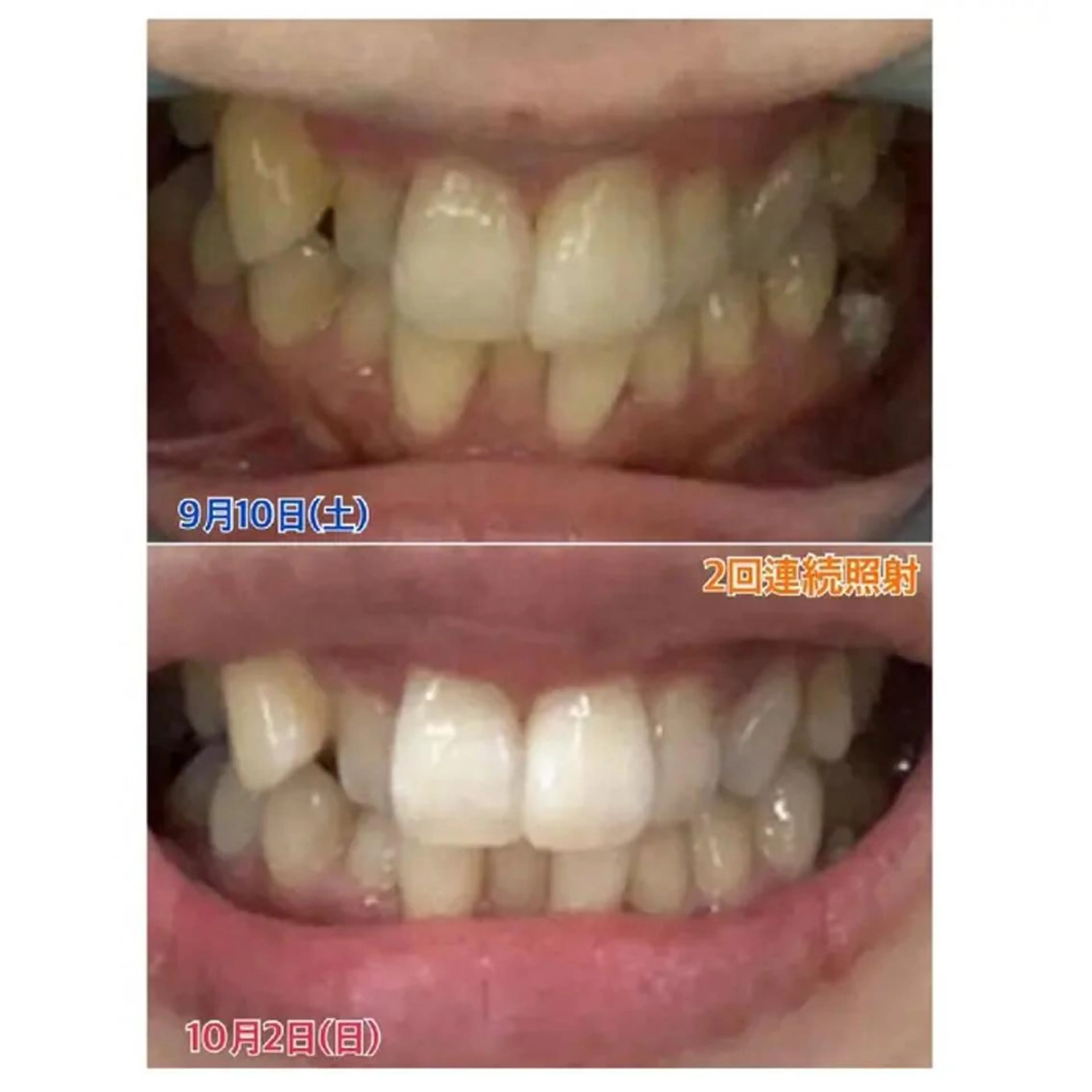 Ｍ渋谷 ホワイトニングのエステ・リラクイメージ