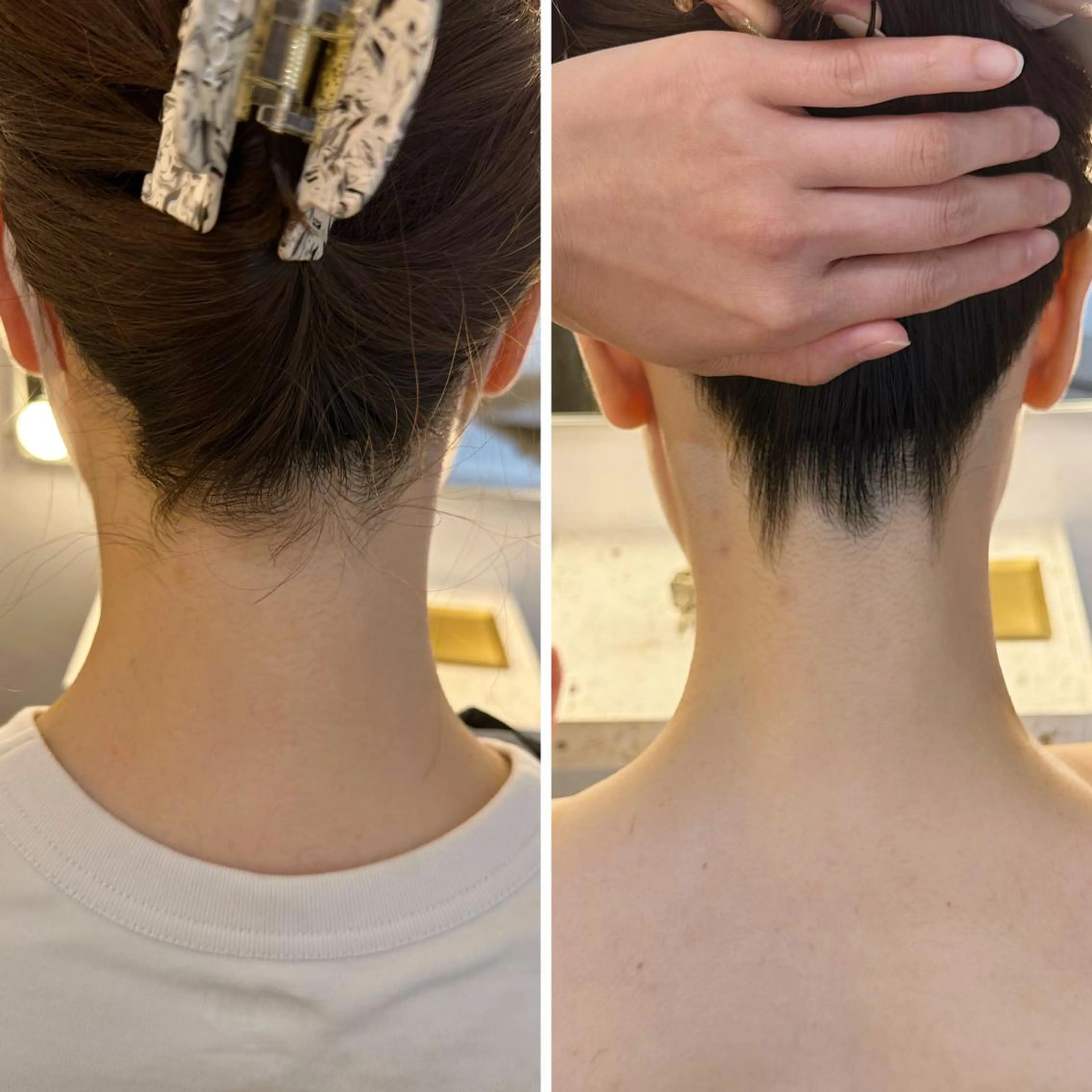 脱毛 うなじ脱毛/美肌脱毛 LABELのエステ・リラクイメージ