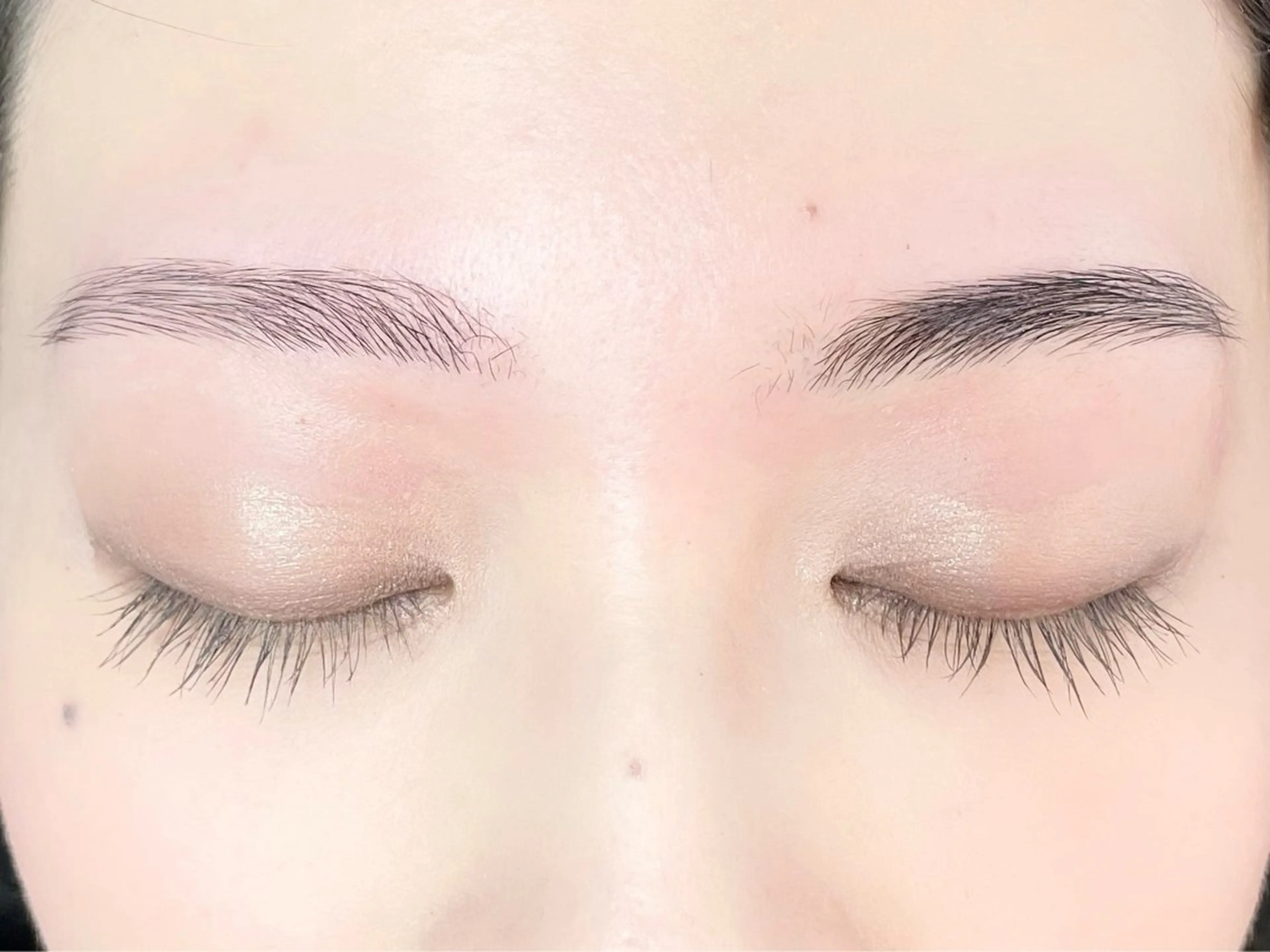 ワックス脱毛、間引きの写真