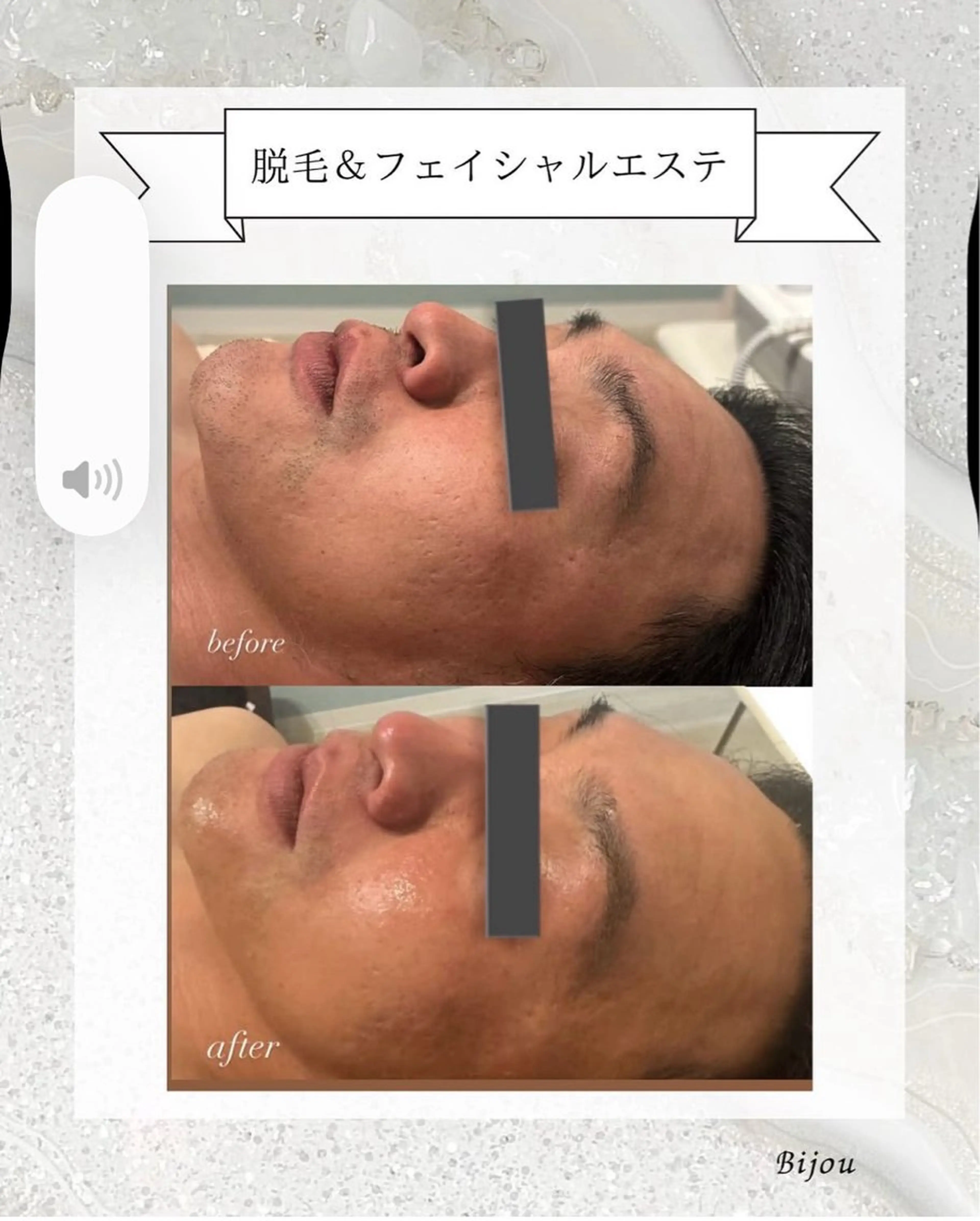 メンズ 梅野 さくらのエステ・リラクイメージ