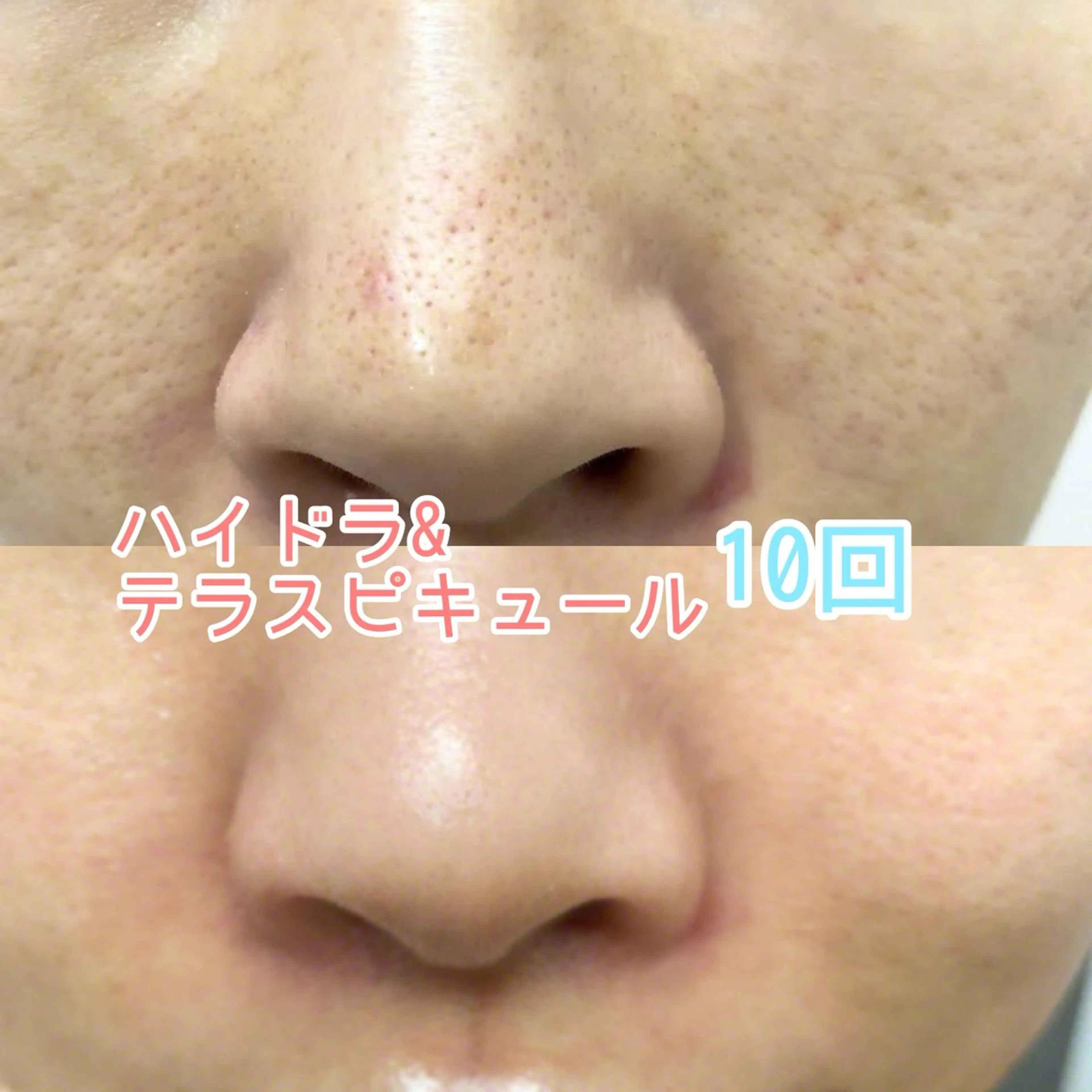 vary  clue MISAのその他イメージ