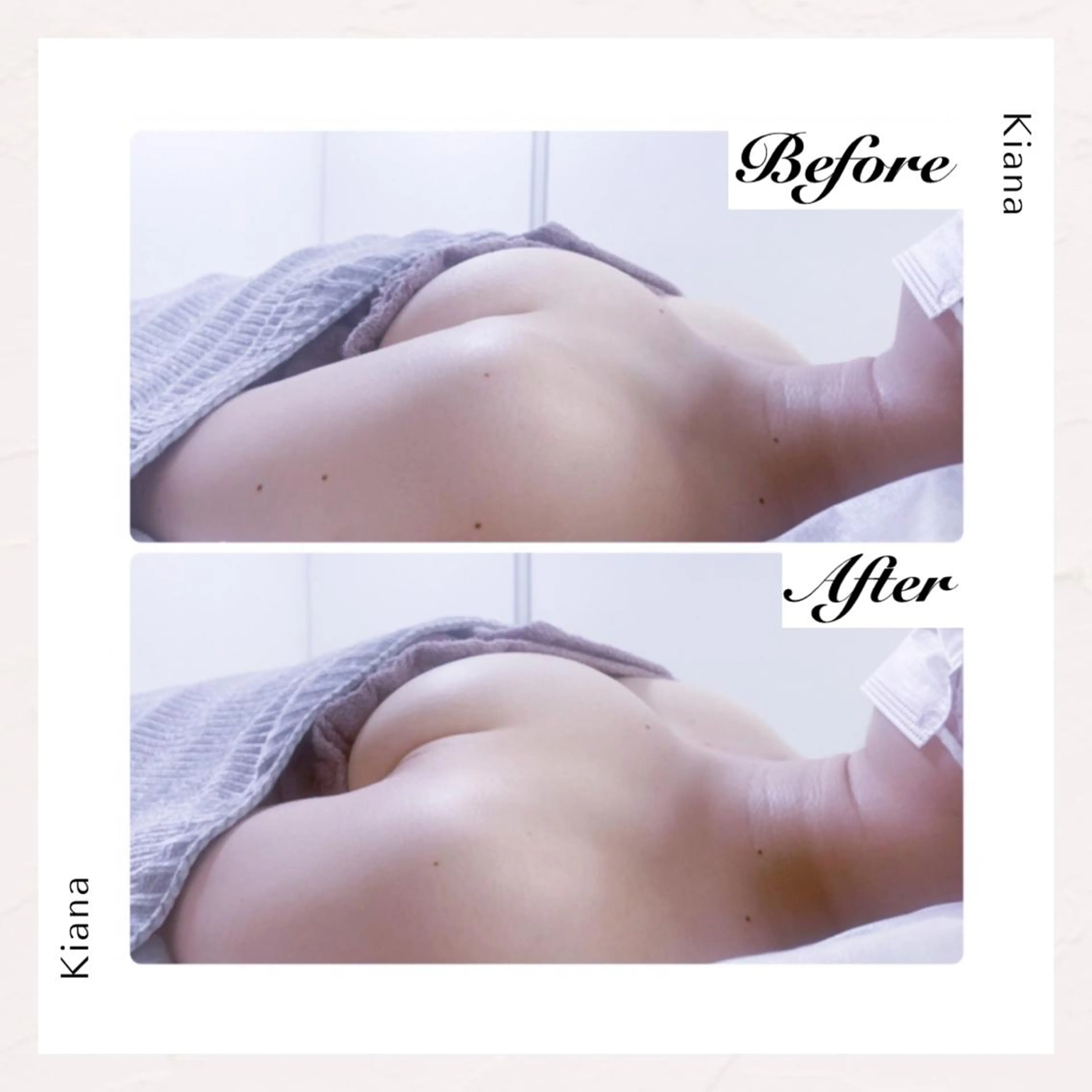 エステ リラク バスト専門Kiana 風のエステ・リラクイメージ