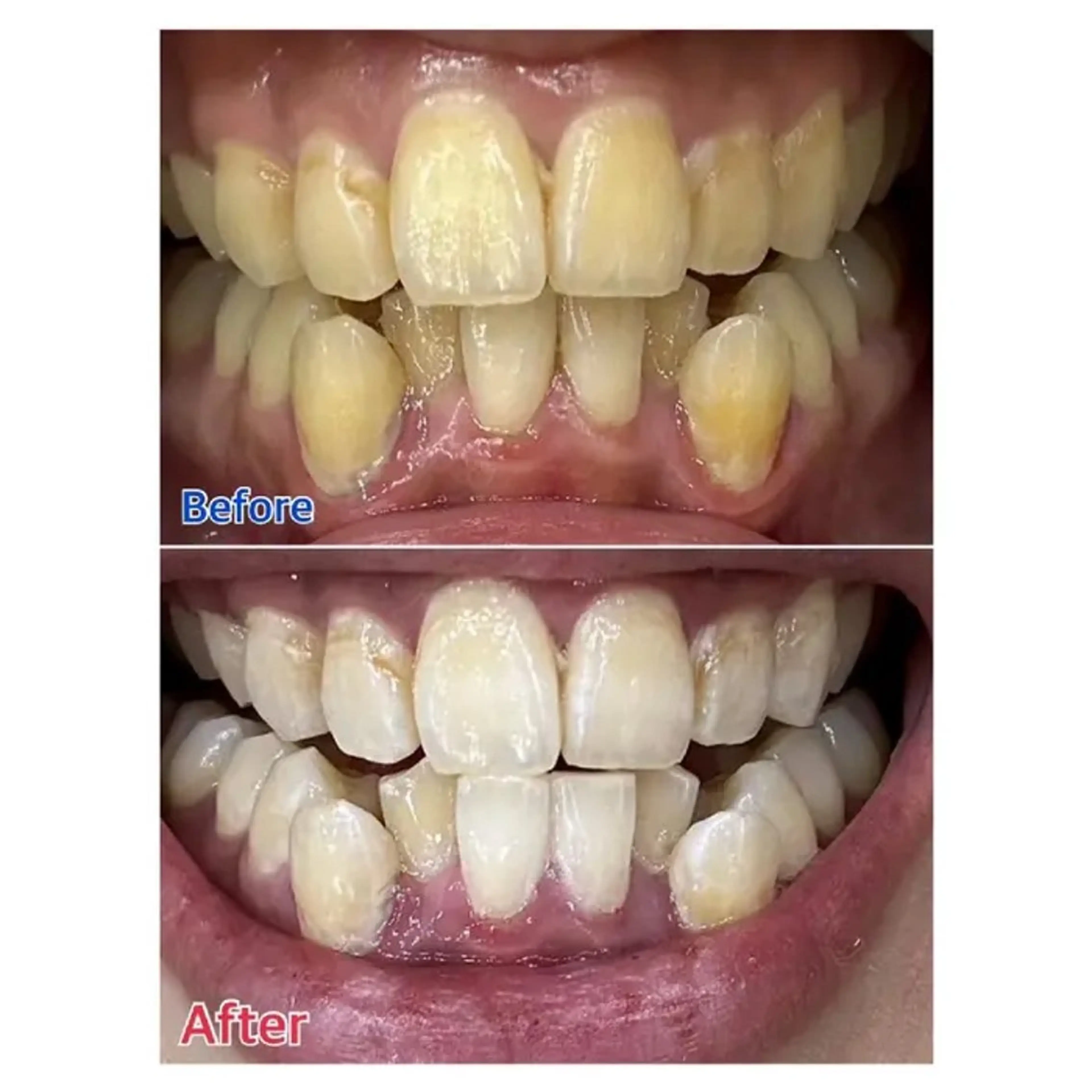 M渋谷 ホワイトニングのエステ・リラクイメージ