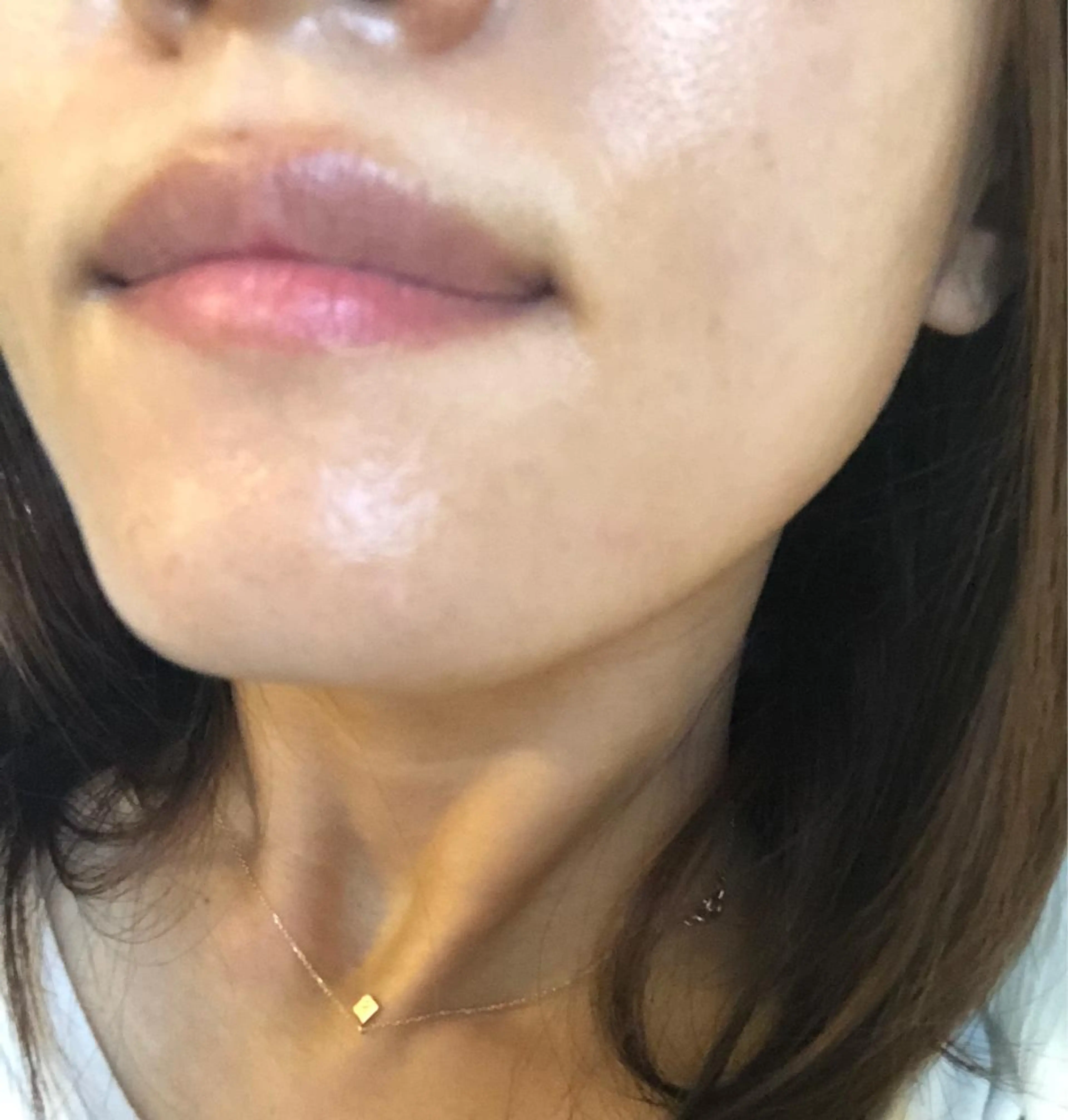 Momo Eggs所属・Momo Eggsのエステ・リラクイメージ