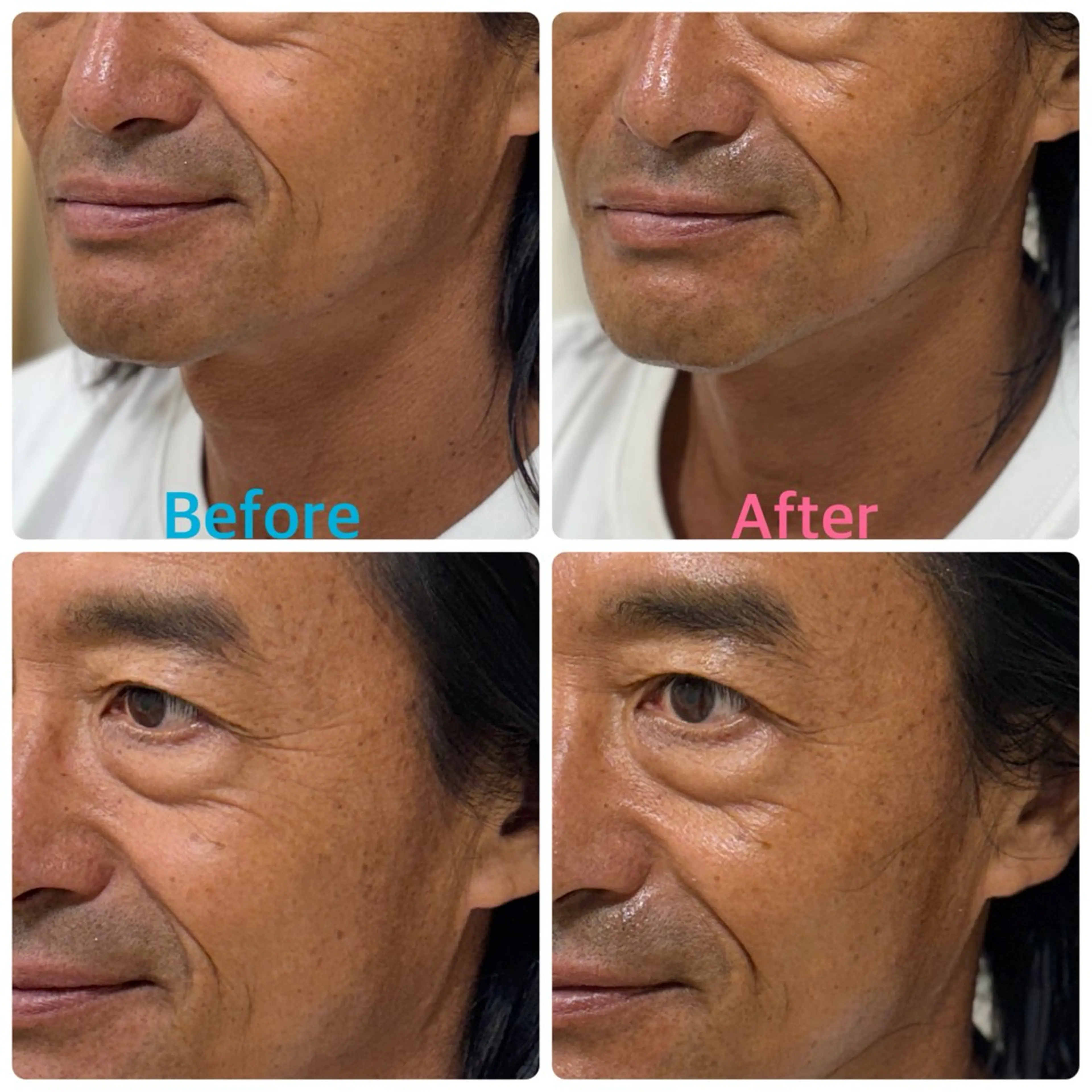 メンズ エステ リラク 安眠ヘッドスパ整体 🌿白金/目黒/鈴木のエステ・リラクイメージ