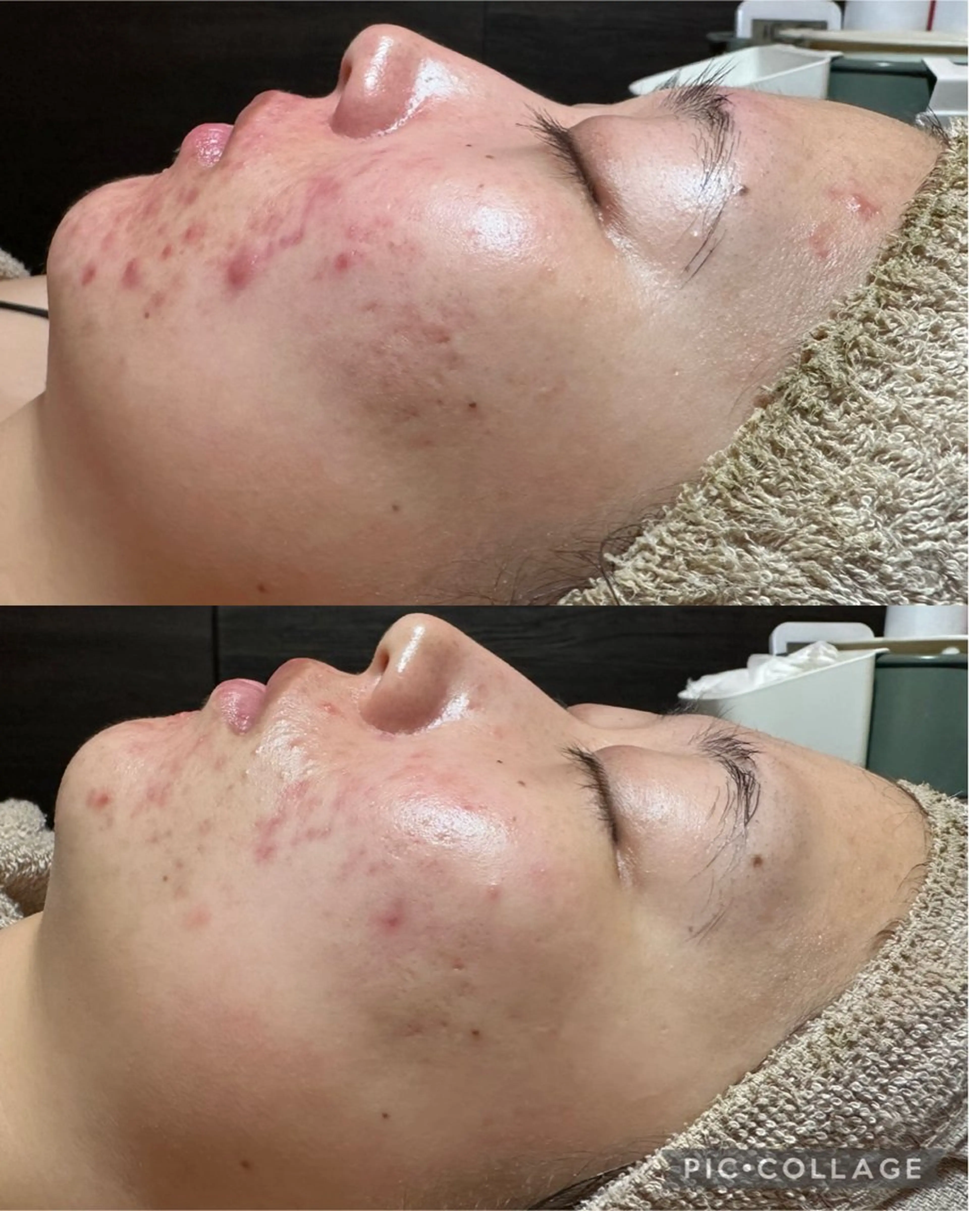 エステ Feel♡ JYURIAのネイルデザイン