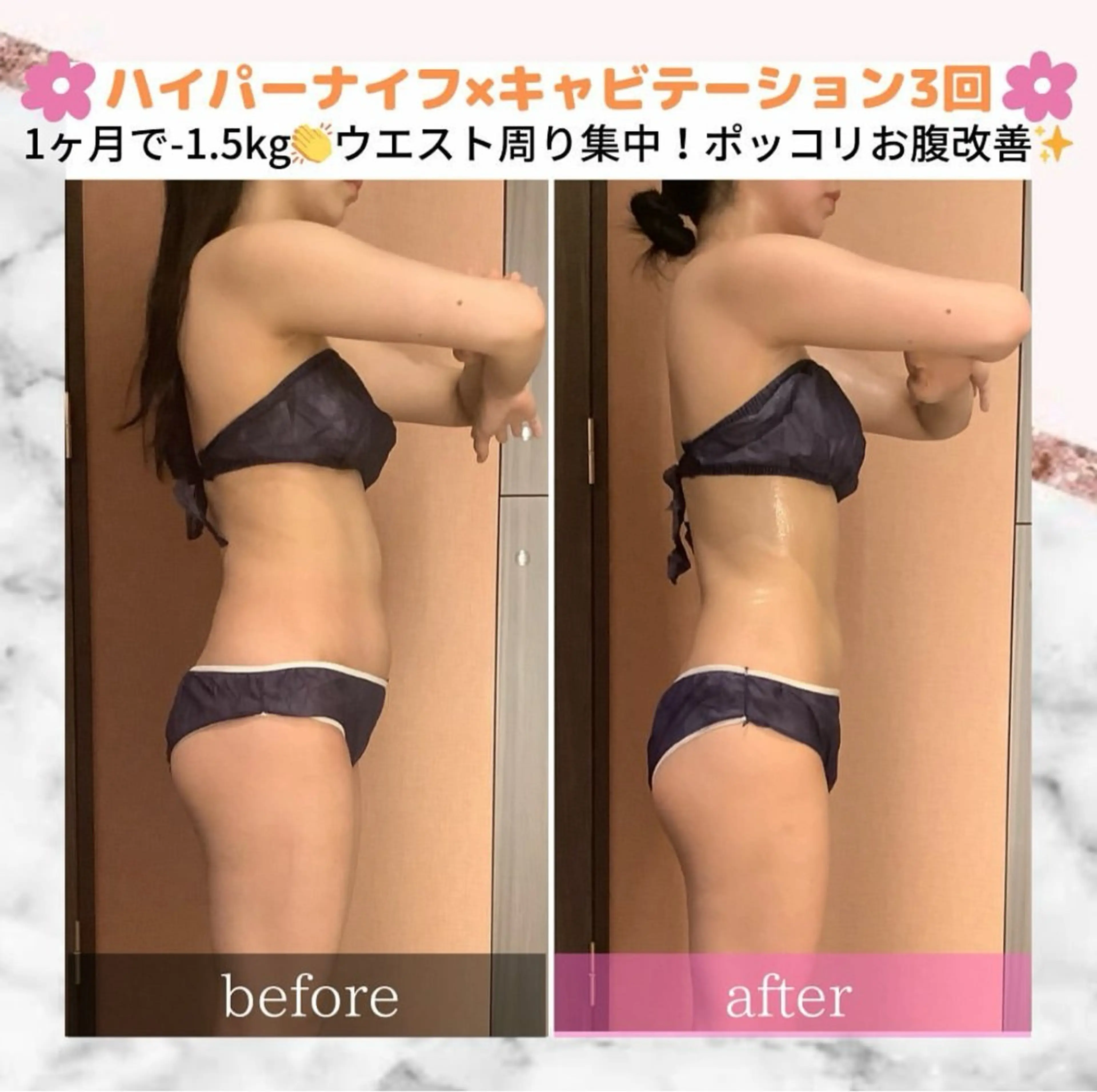 ハイパーナイフ/痩身 🌸CHARME原井のエステ・リラクイメージ