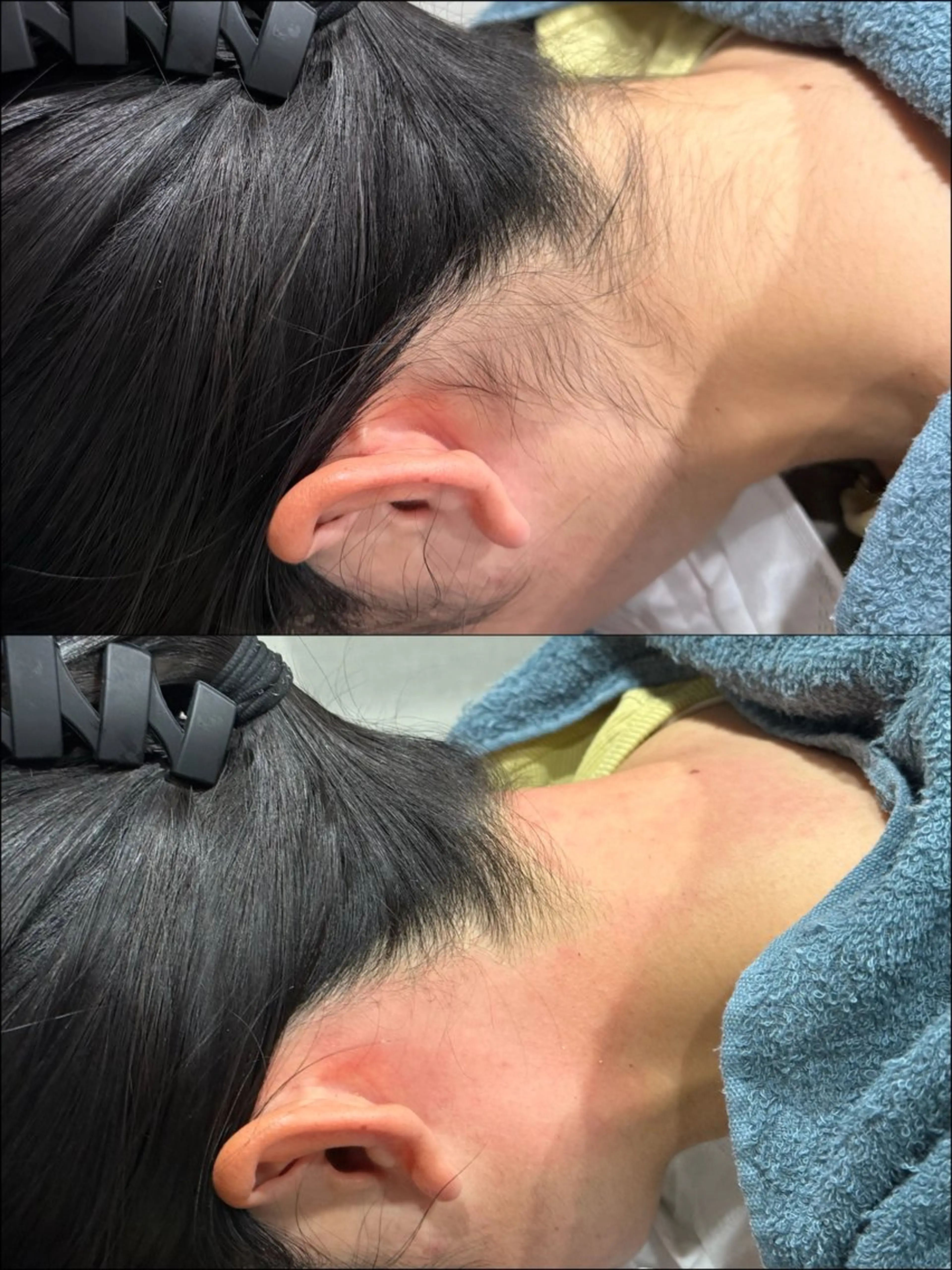 脱毛 LiZA エステティックサロンのエステ・リラクイメージ