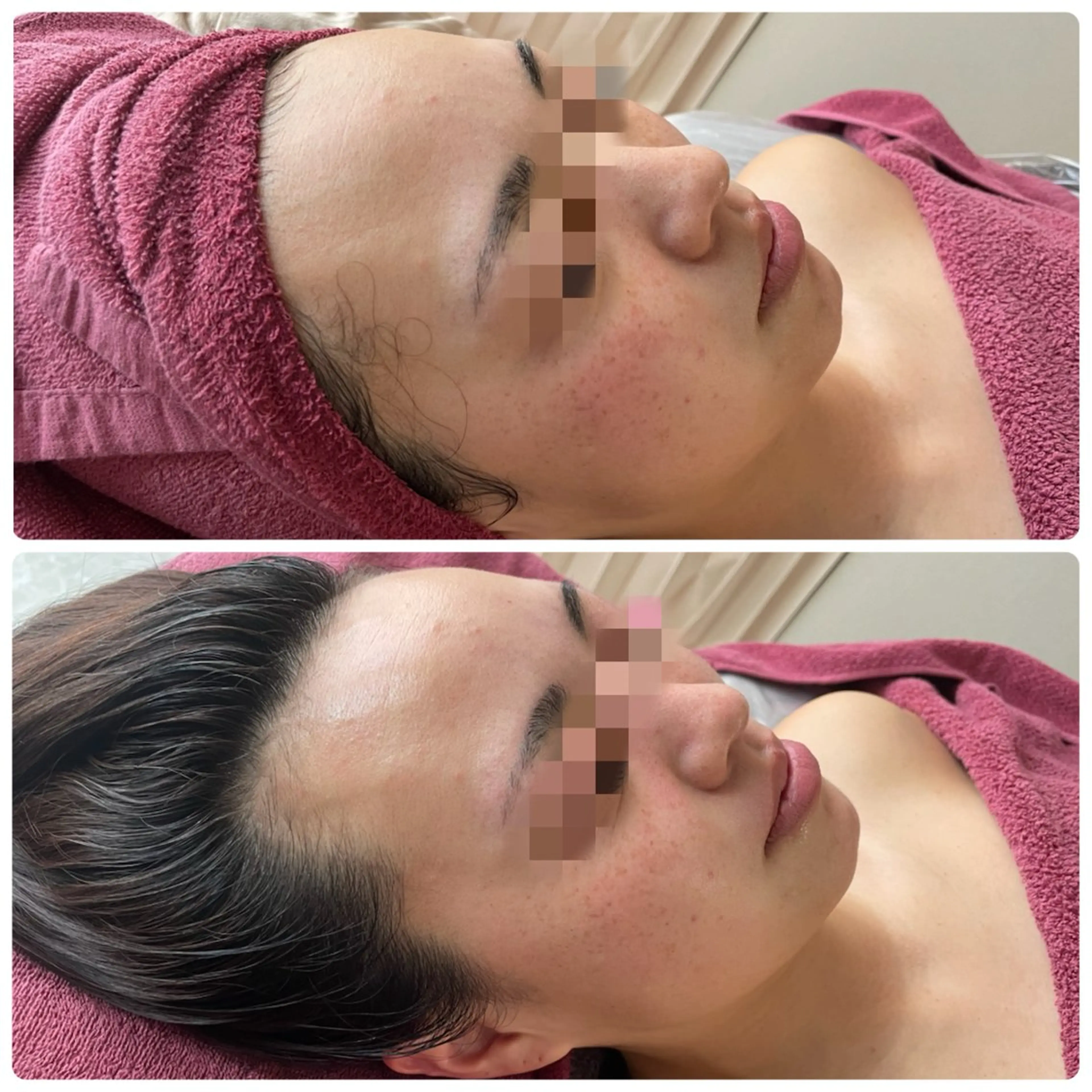 【代謝×免疫UP】お肌と身体のオールハンド専門店estheya sign所属・深層筋×筋膜リリース 首肩こり/むくみのエステ・リラクイメージ