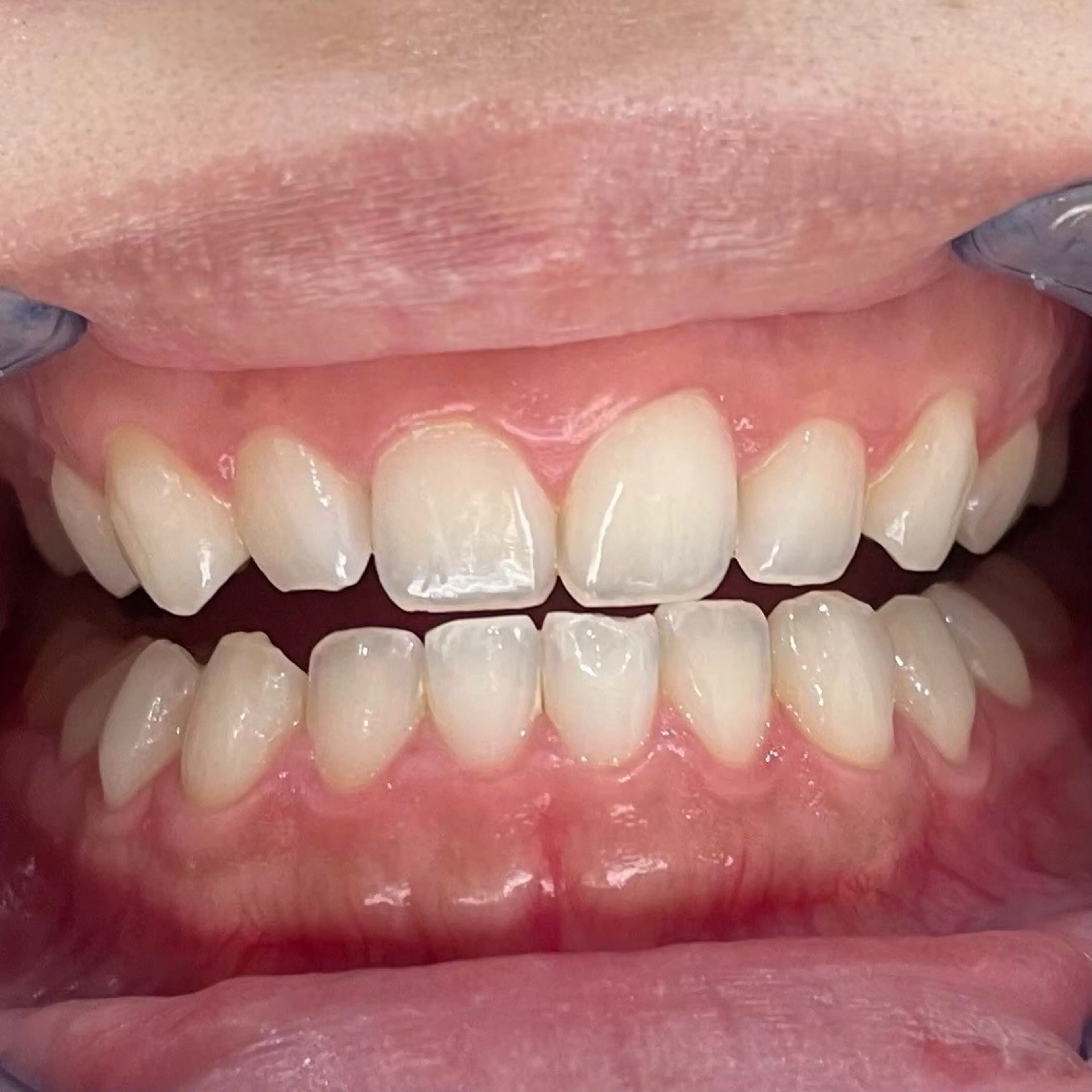 セルフホワイトニング サクホワ五反田店のその他イメージ