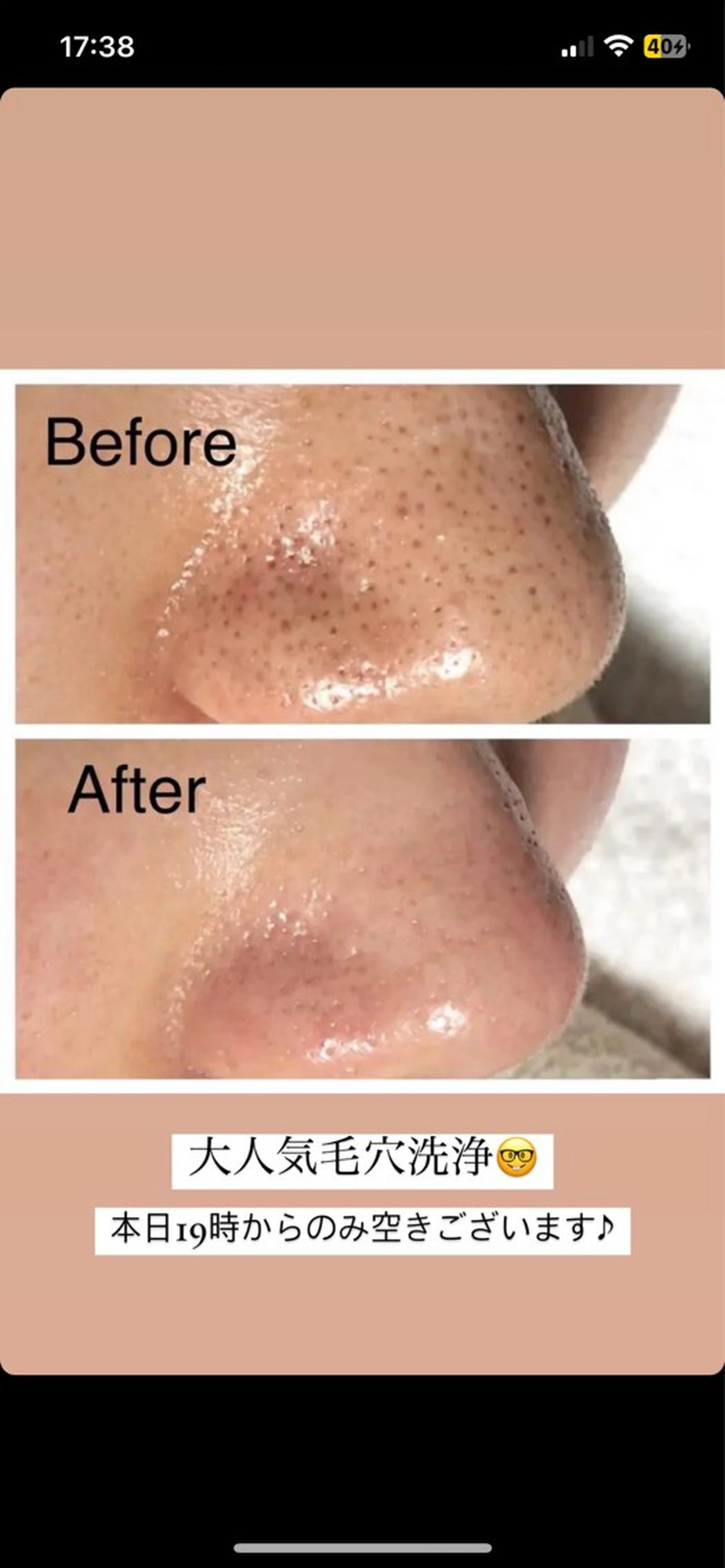 脱毛・眉毛・フェイス サロンN久留米店の眉毛・アイブロウイメージ